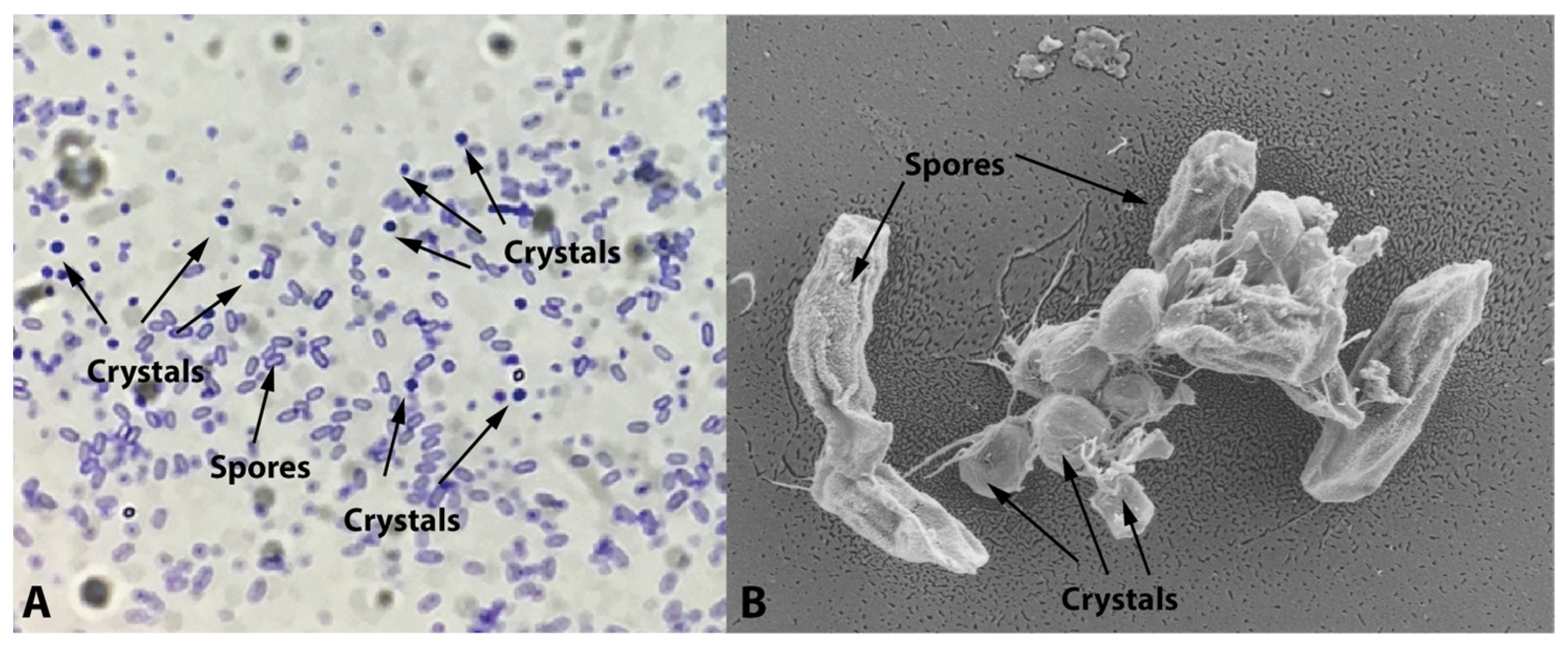 Bacillus Thuringiensis Bacteria #2 by Scimat