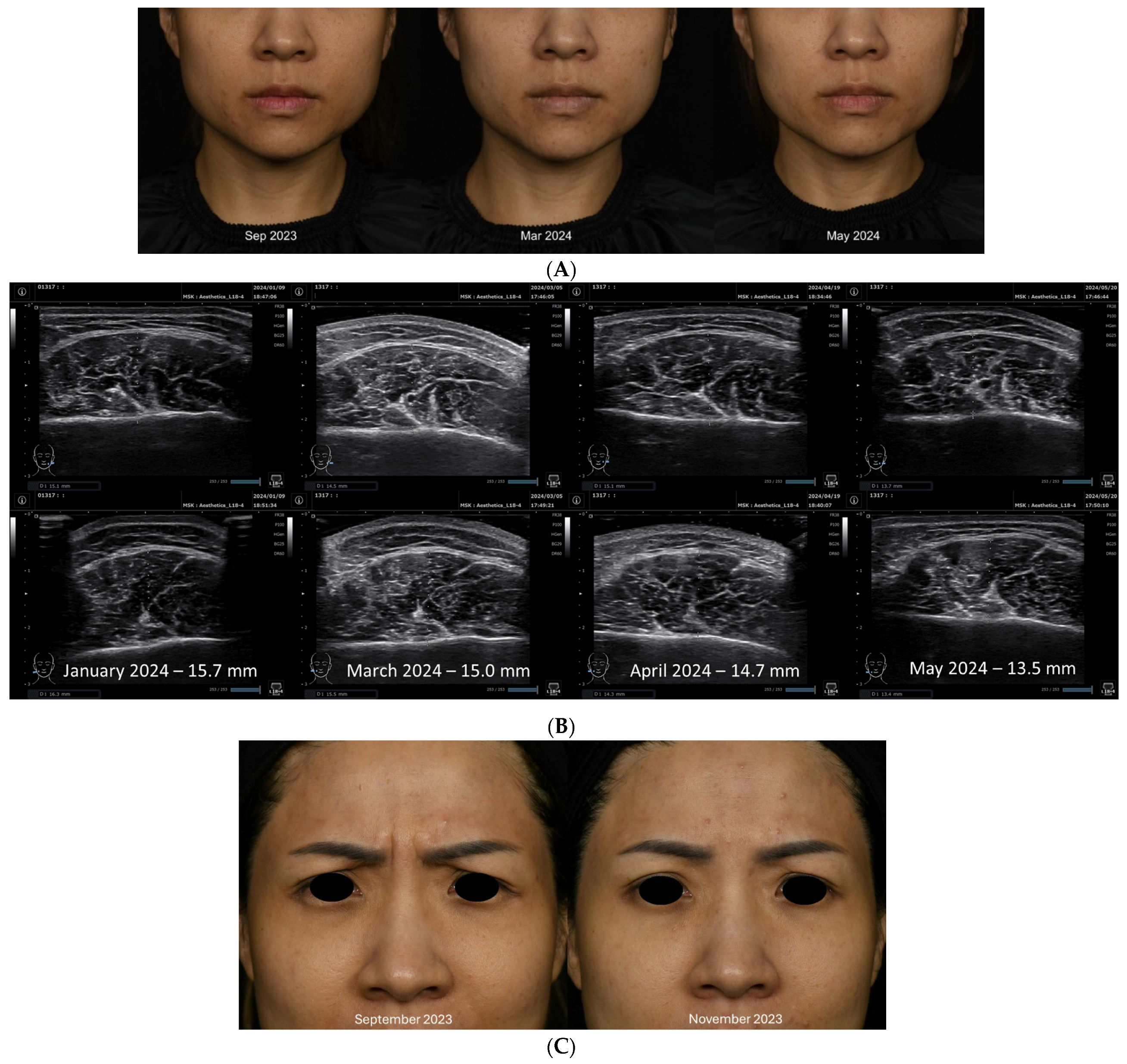 Toxins 16 00422 g004