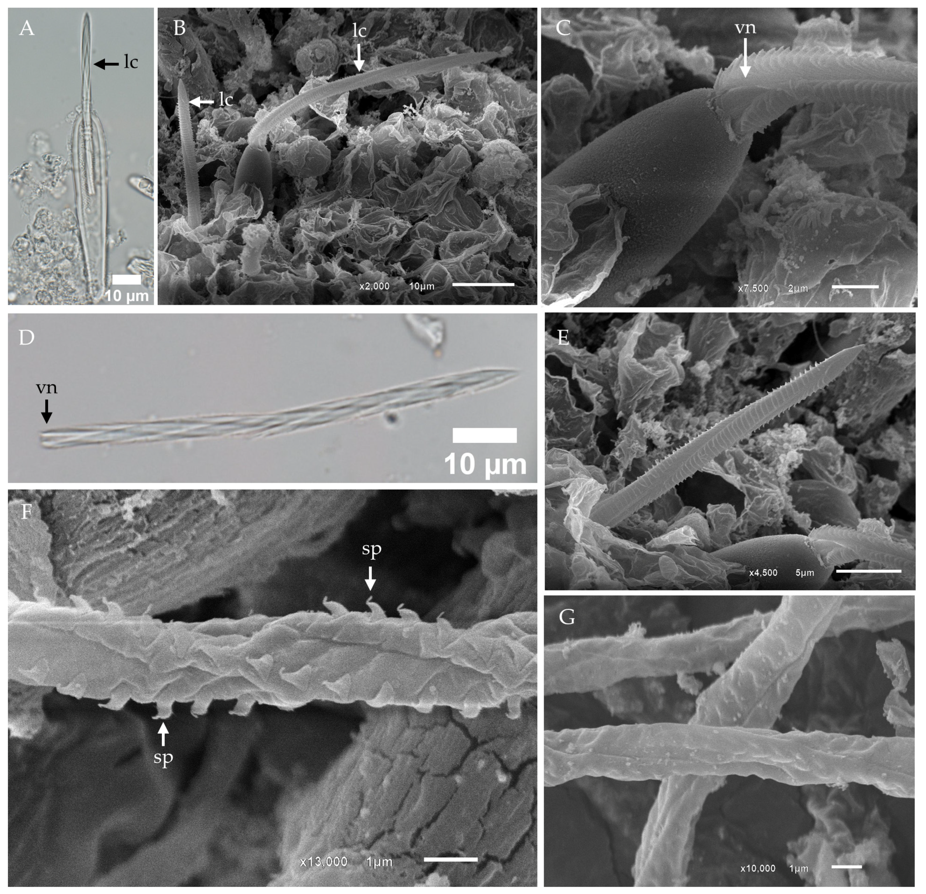 Toxins 17 00044 g002
