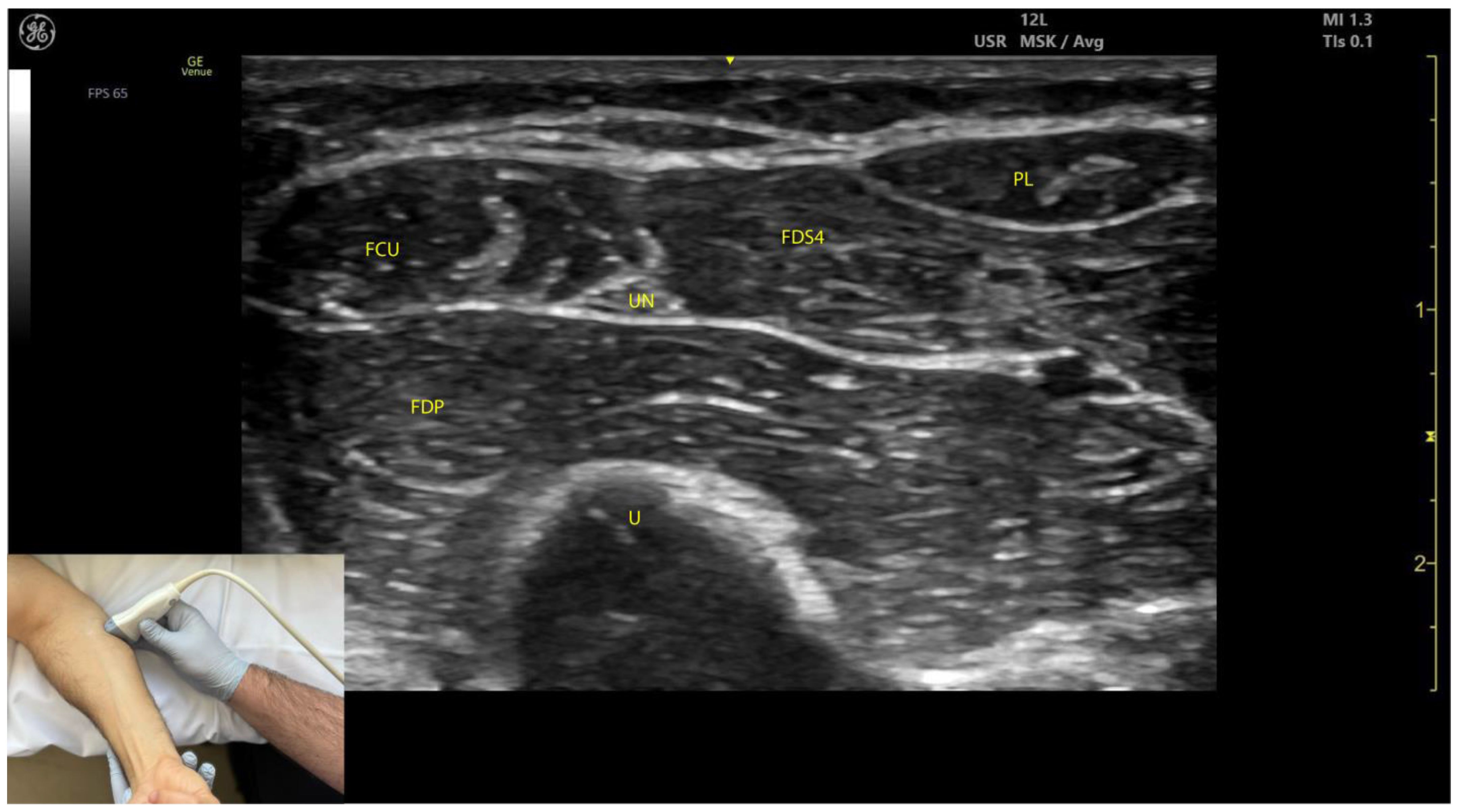 Toxins 17 00107 g005