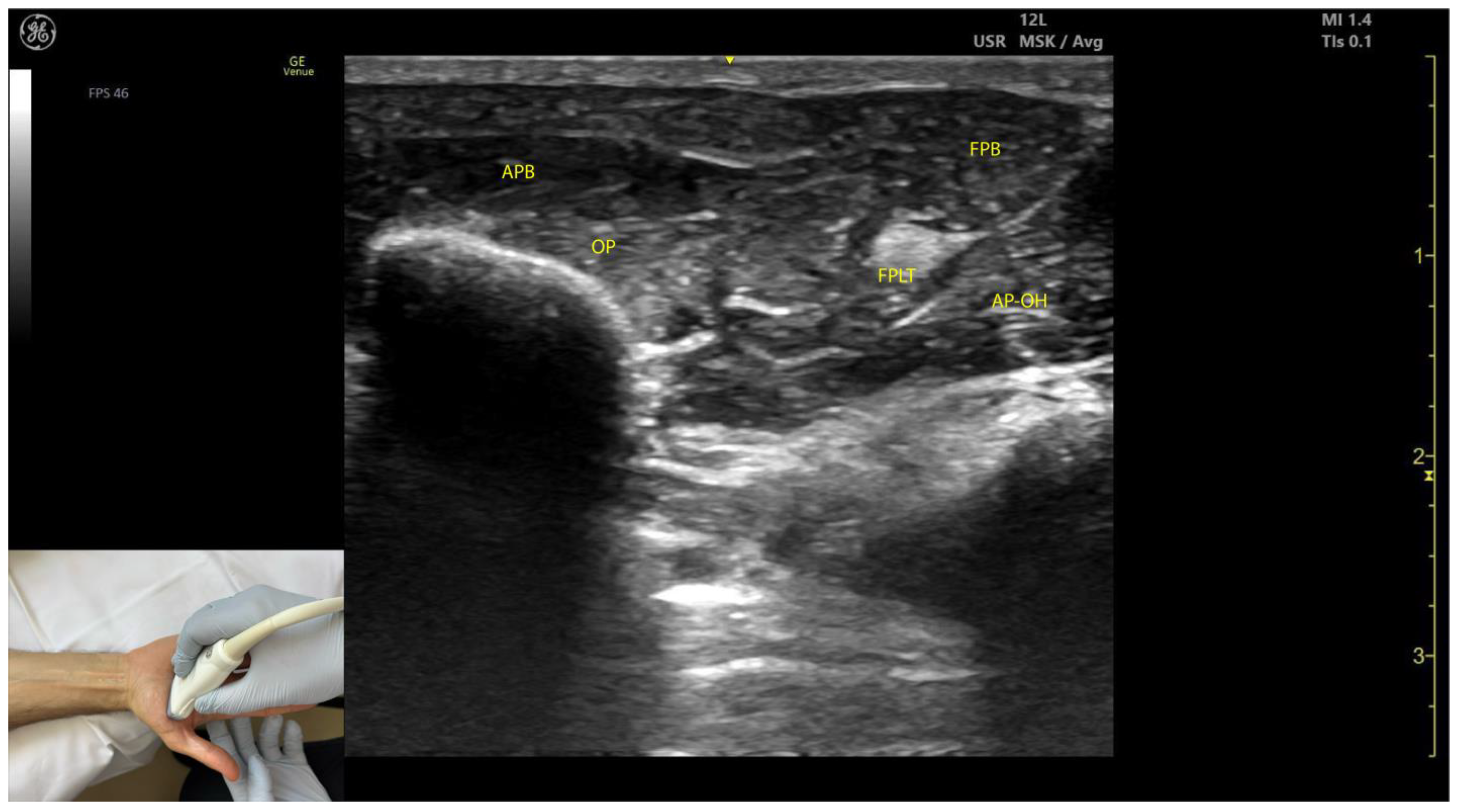 Toxins 17 00107 g008