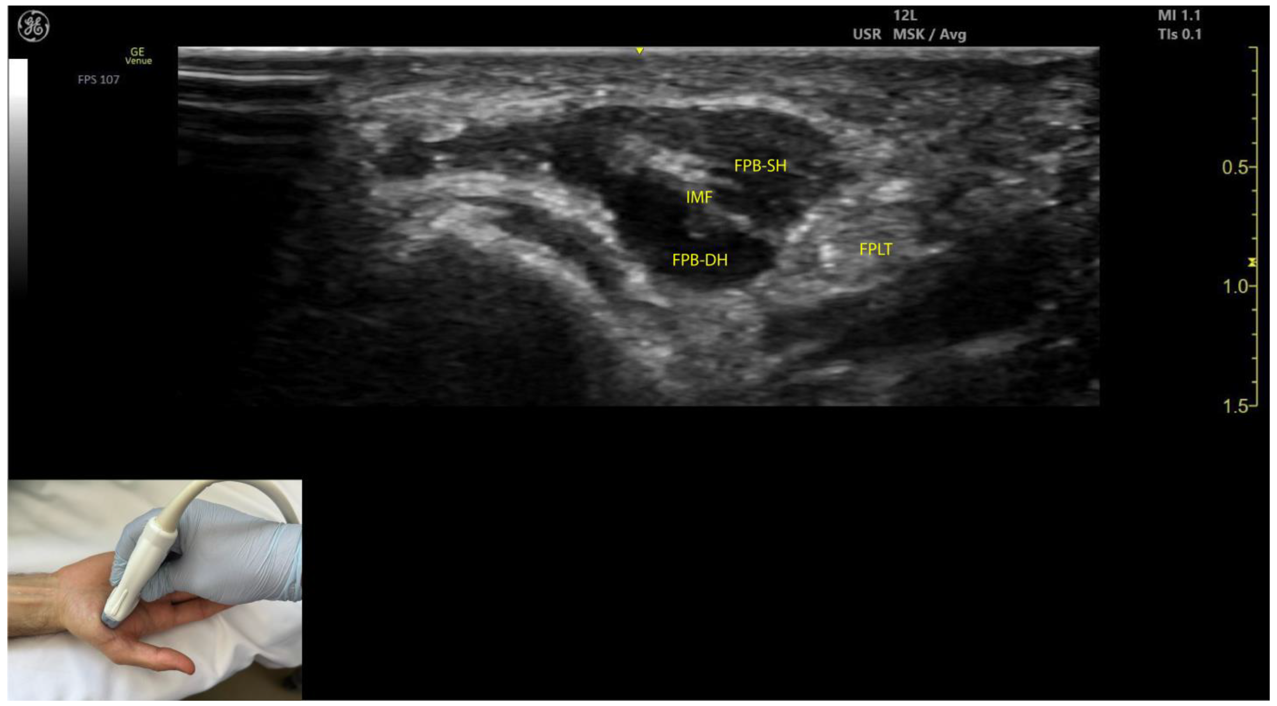 Toxins 17 00107 g009