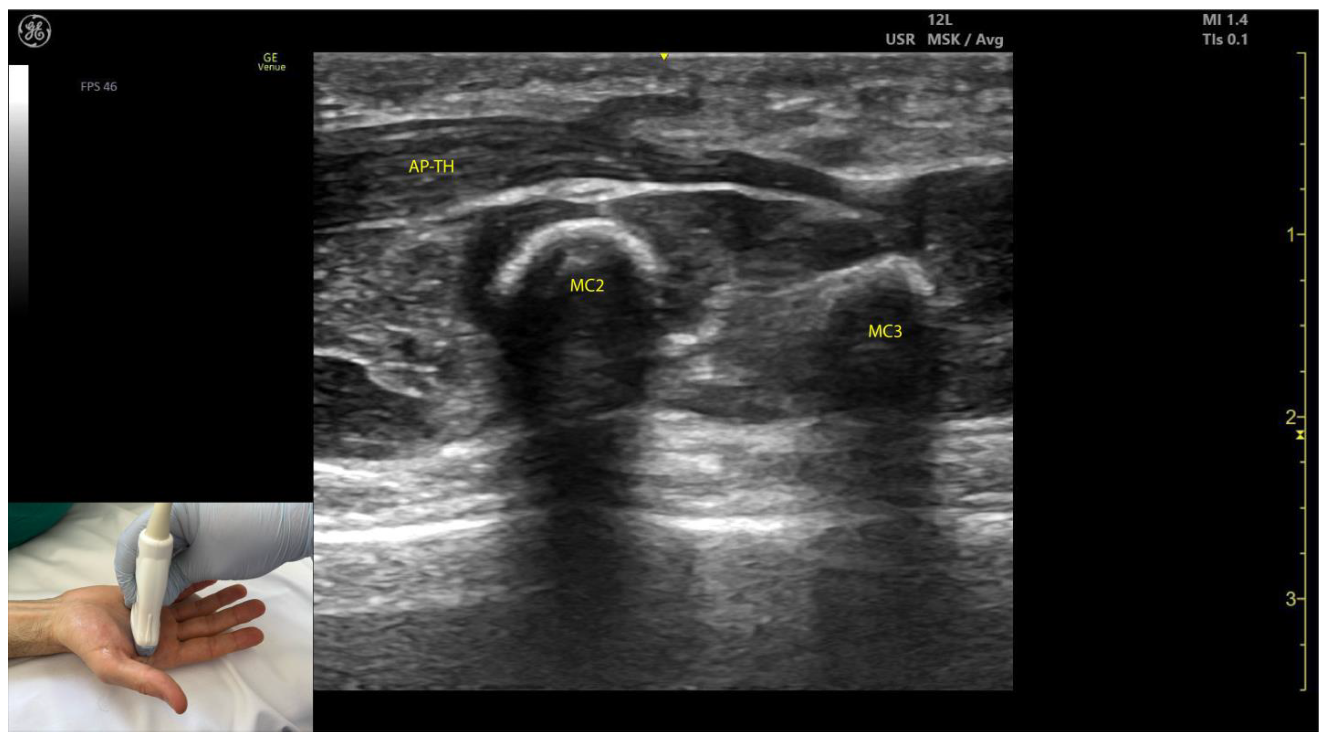Toxins 17 00107 g010