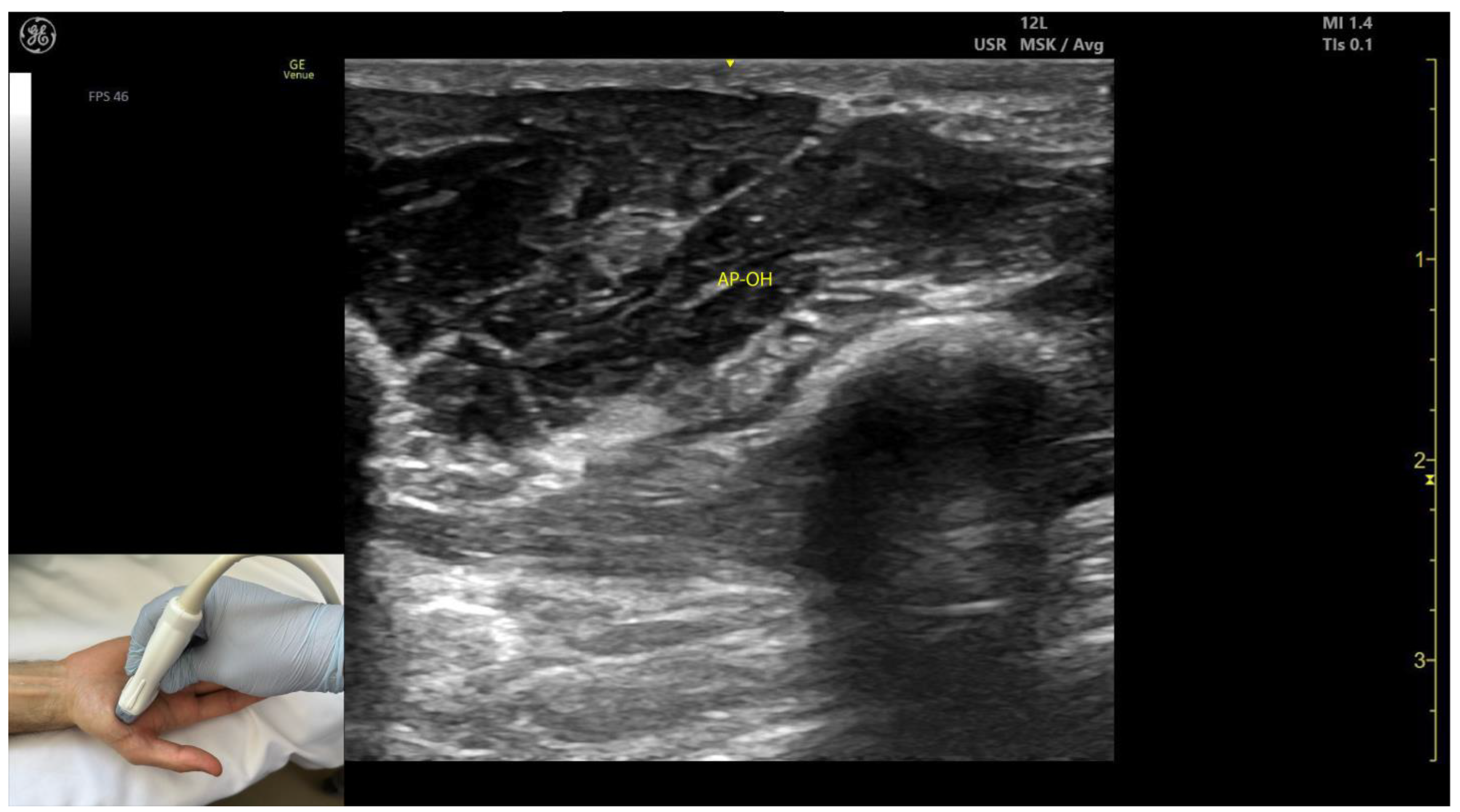 Toxins 17 00107 g011