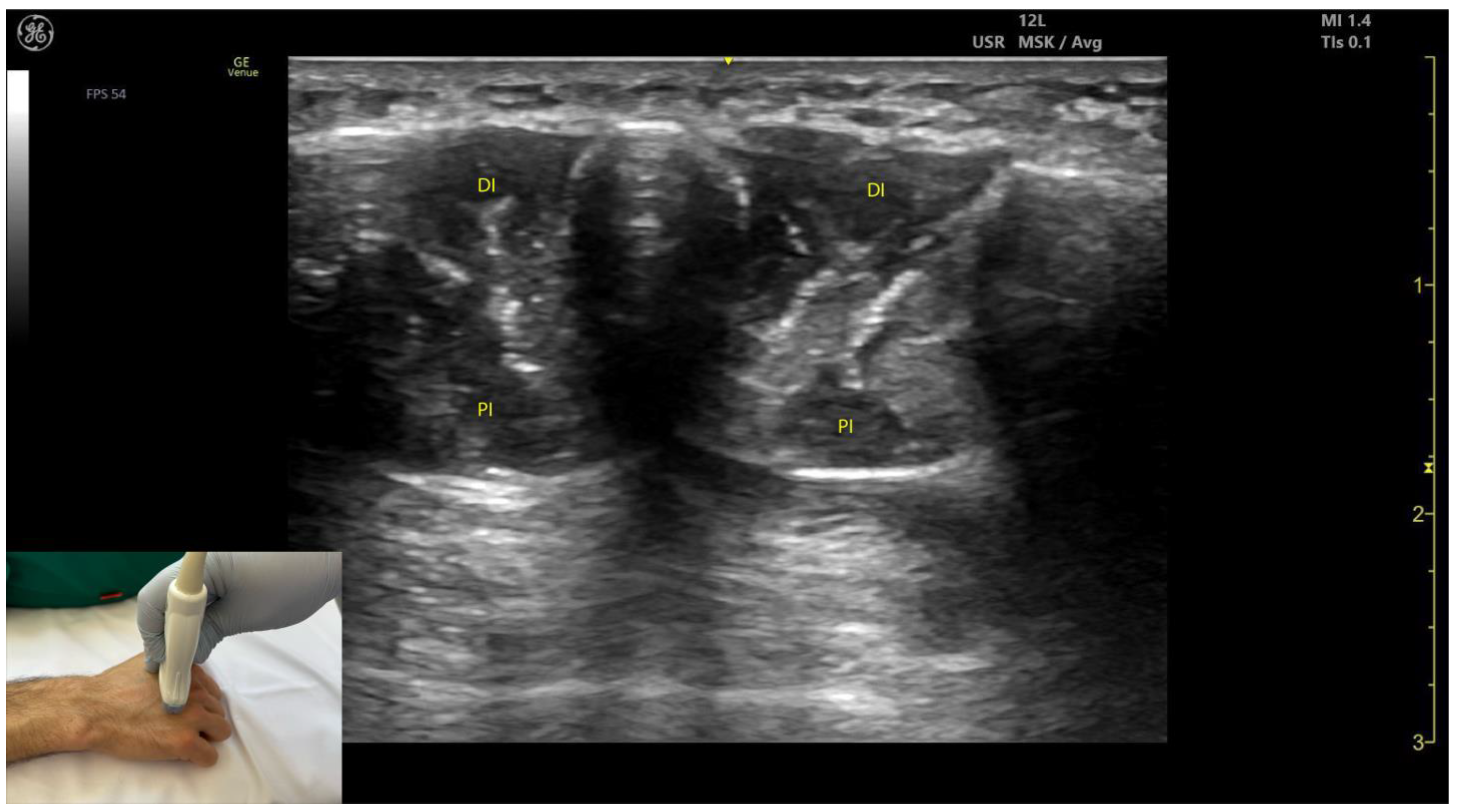 Toxins 17 00107 g013