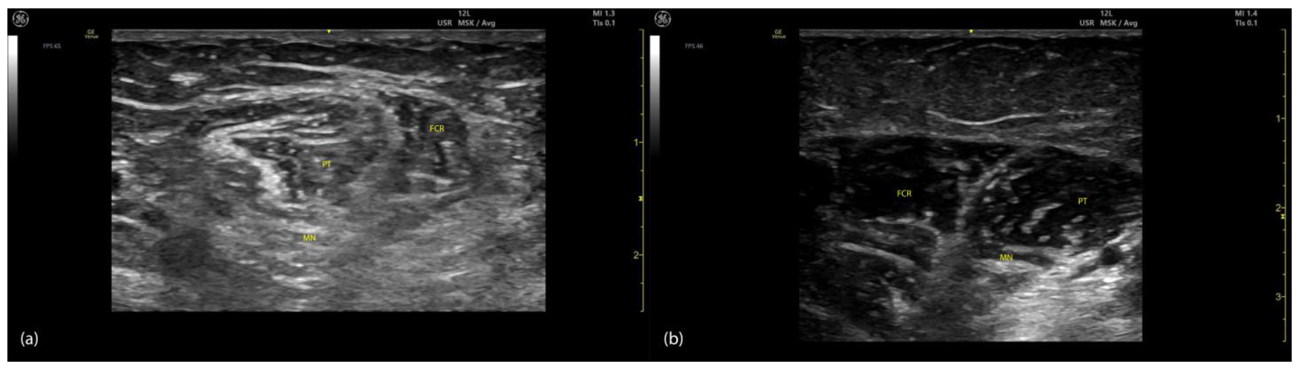 Toxins 17 00107 g014