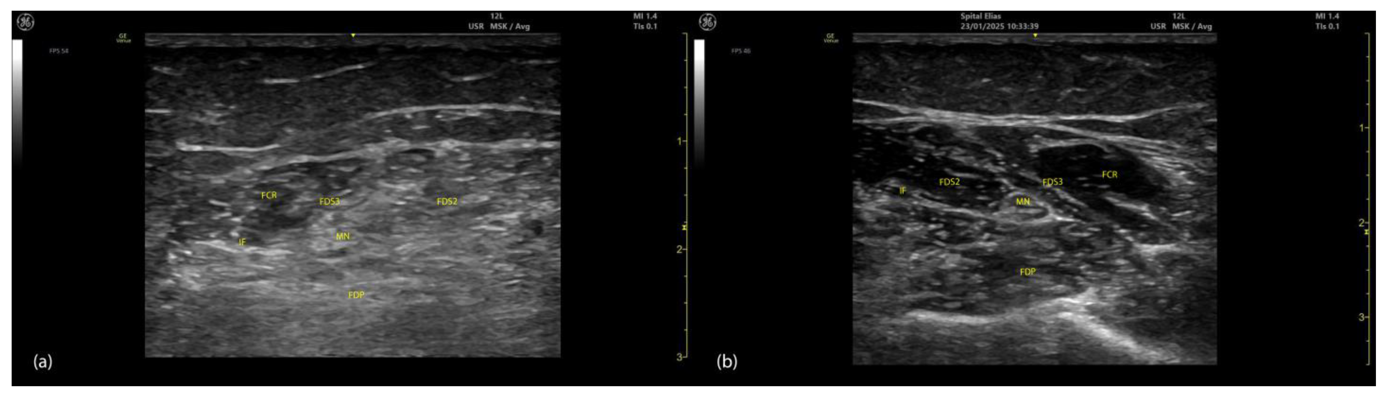 Toxins 17 00107 g015