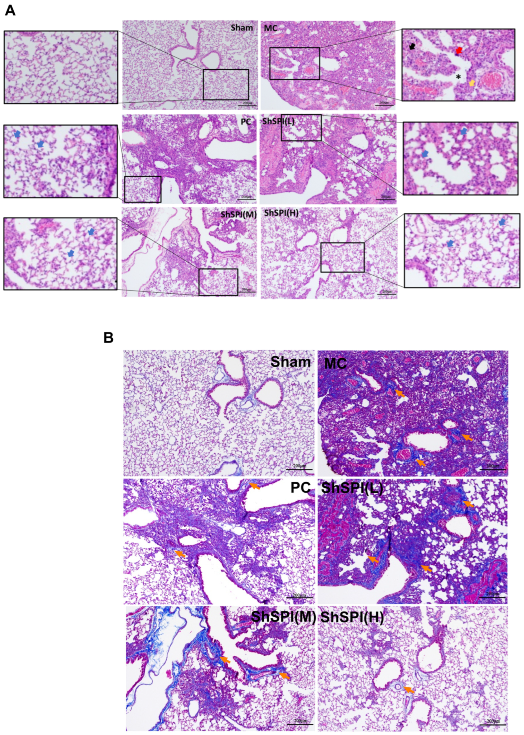 Toxins 17 00213 g002