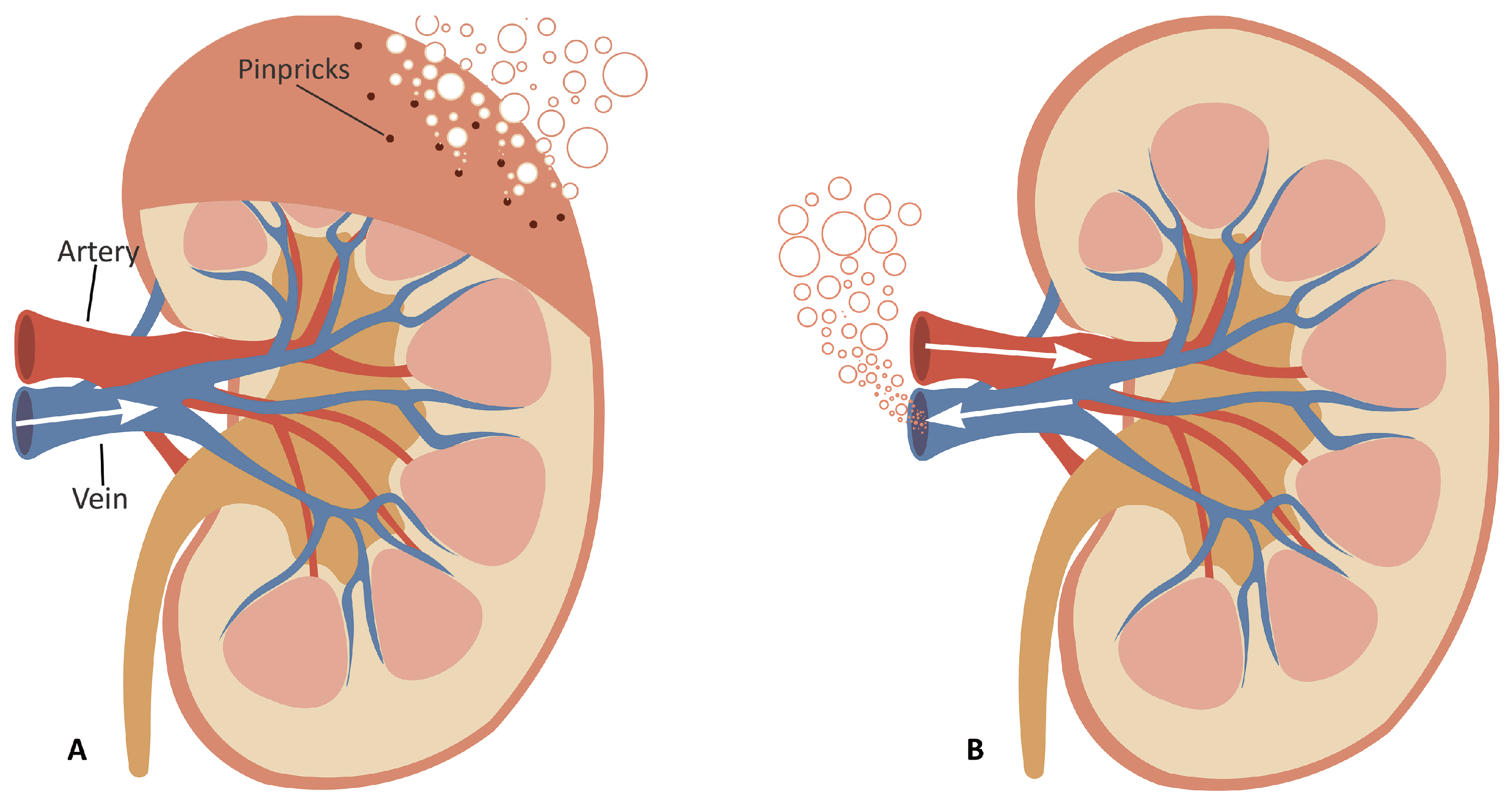 Transplantology 02 00035 g001 Transplantology 02 00035 g001