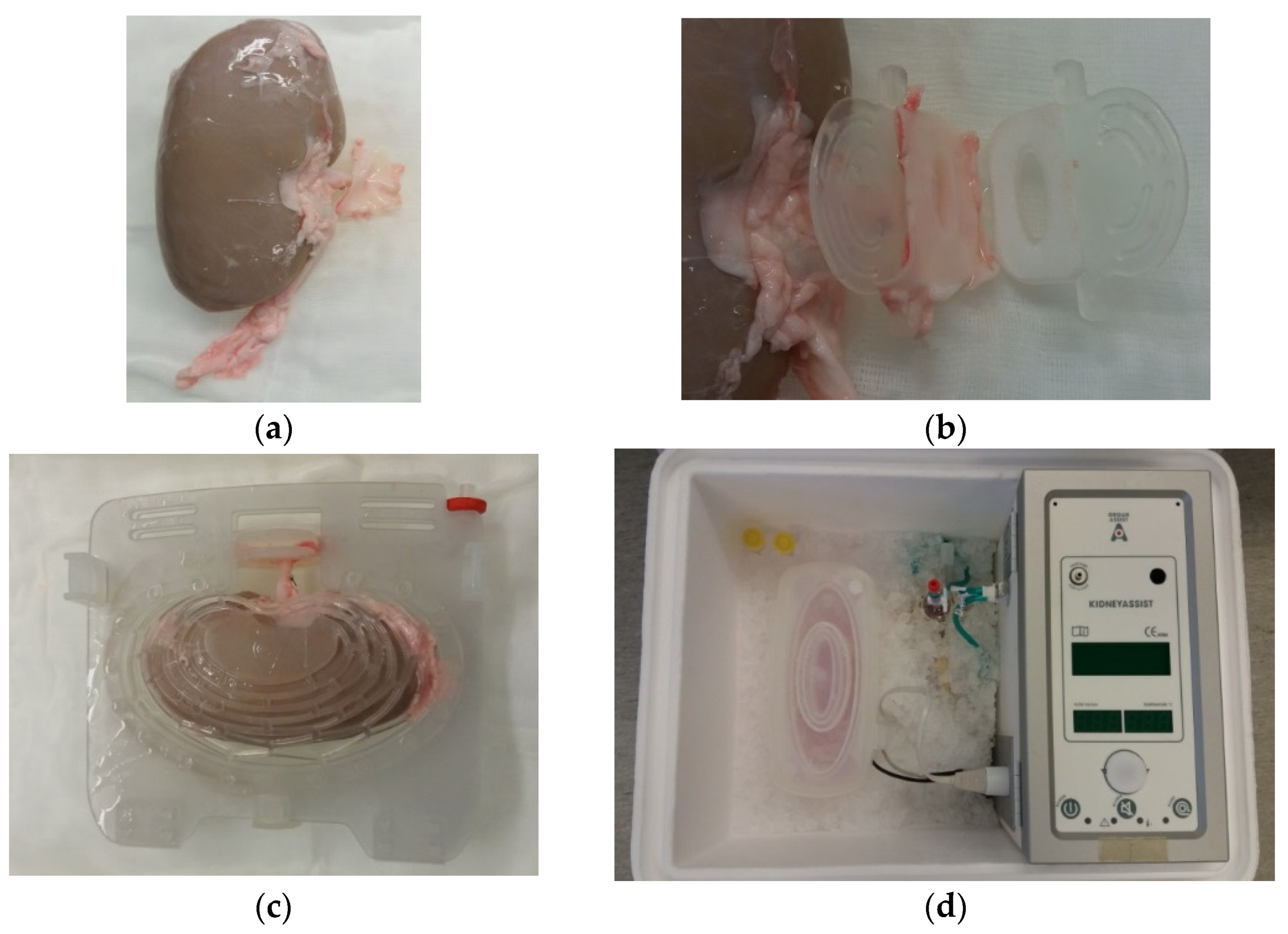 Transplantology 03 00002 g001