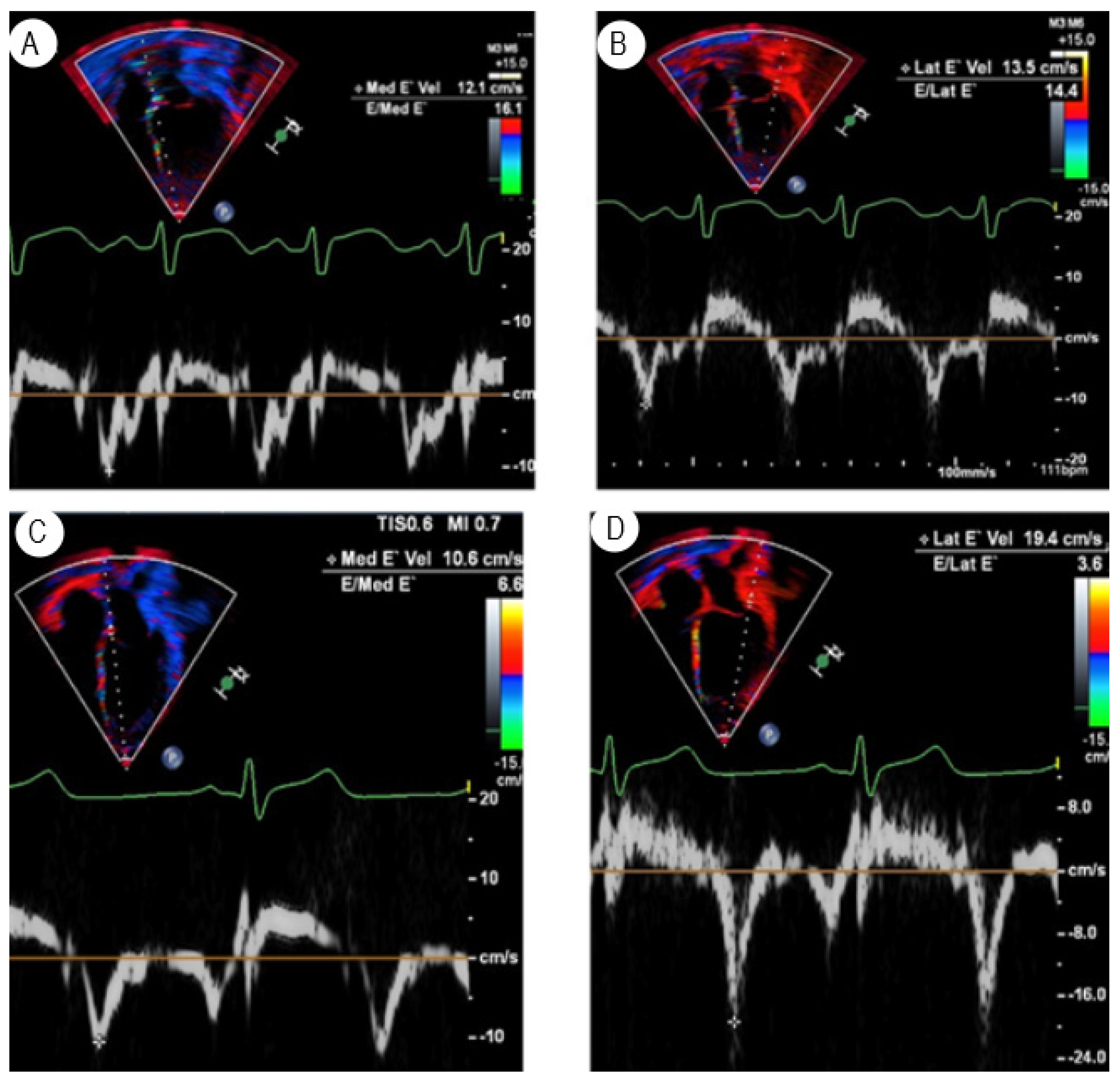 Transplantology 03 00025 g002 Transplantology 03 00025 g002