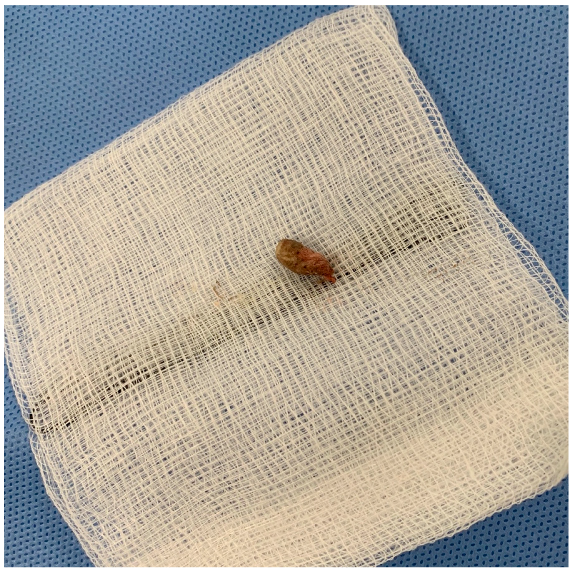 Tropicalmed 04 00120 g002