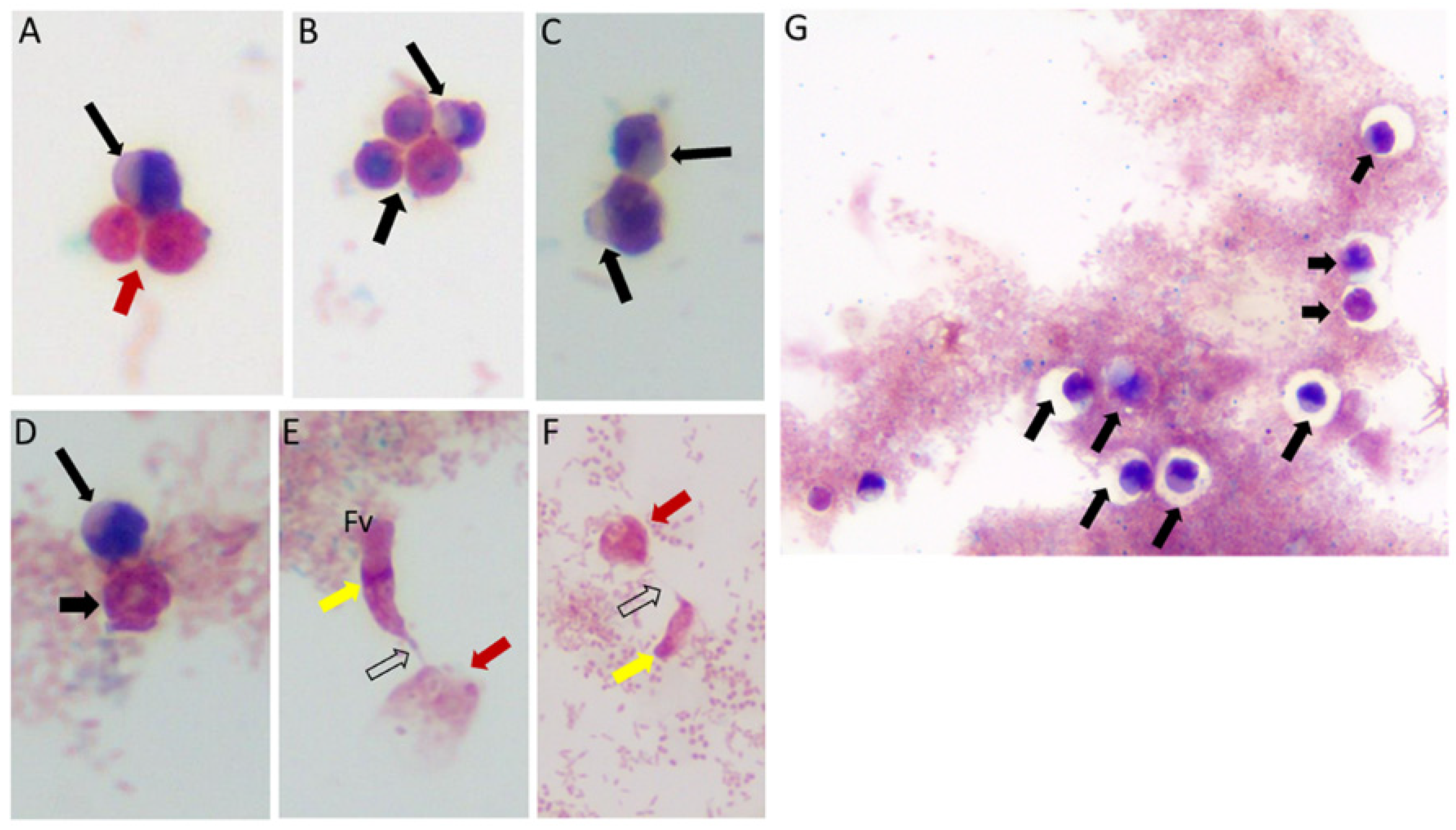 apical area cytology