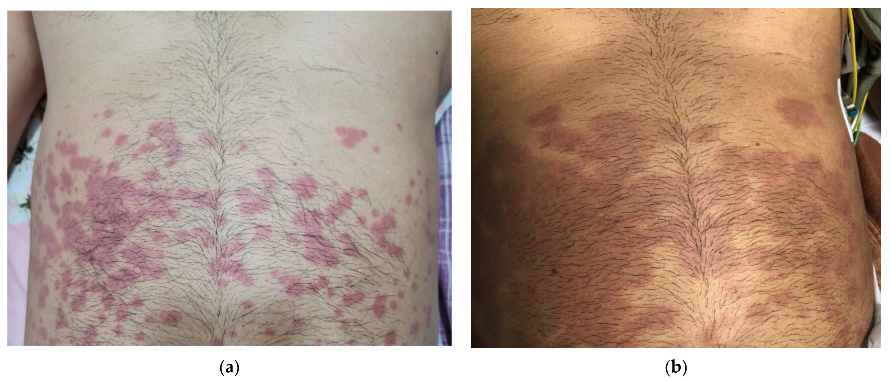 Tropicalmed 06 00187 g001