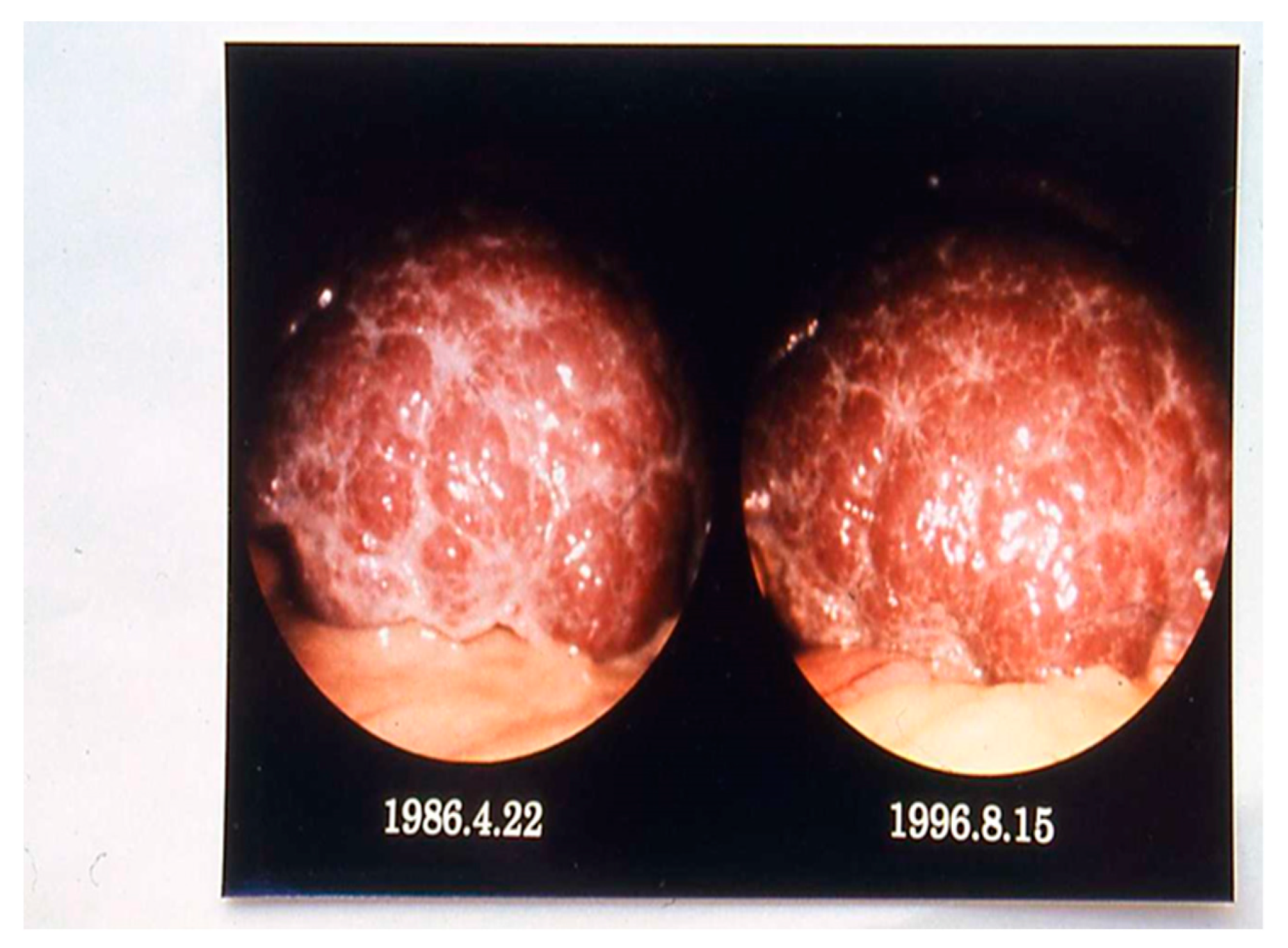 Tropicalmed 07 00055 g006 Tropicalmed 07 00055 g006