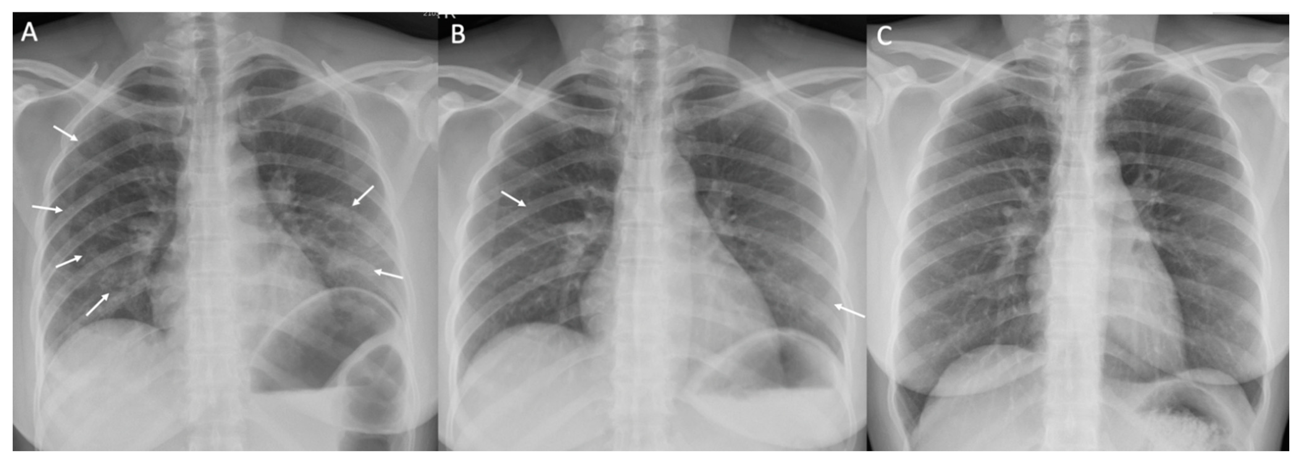 Tropicalmed 07 00238 g002