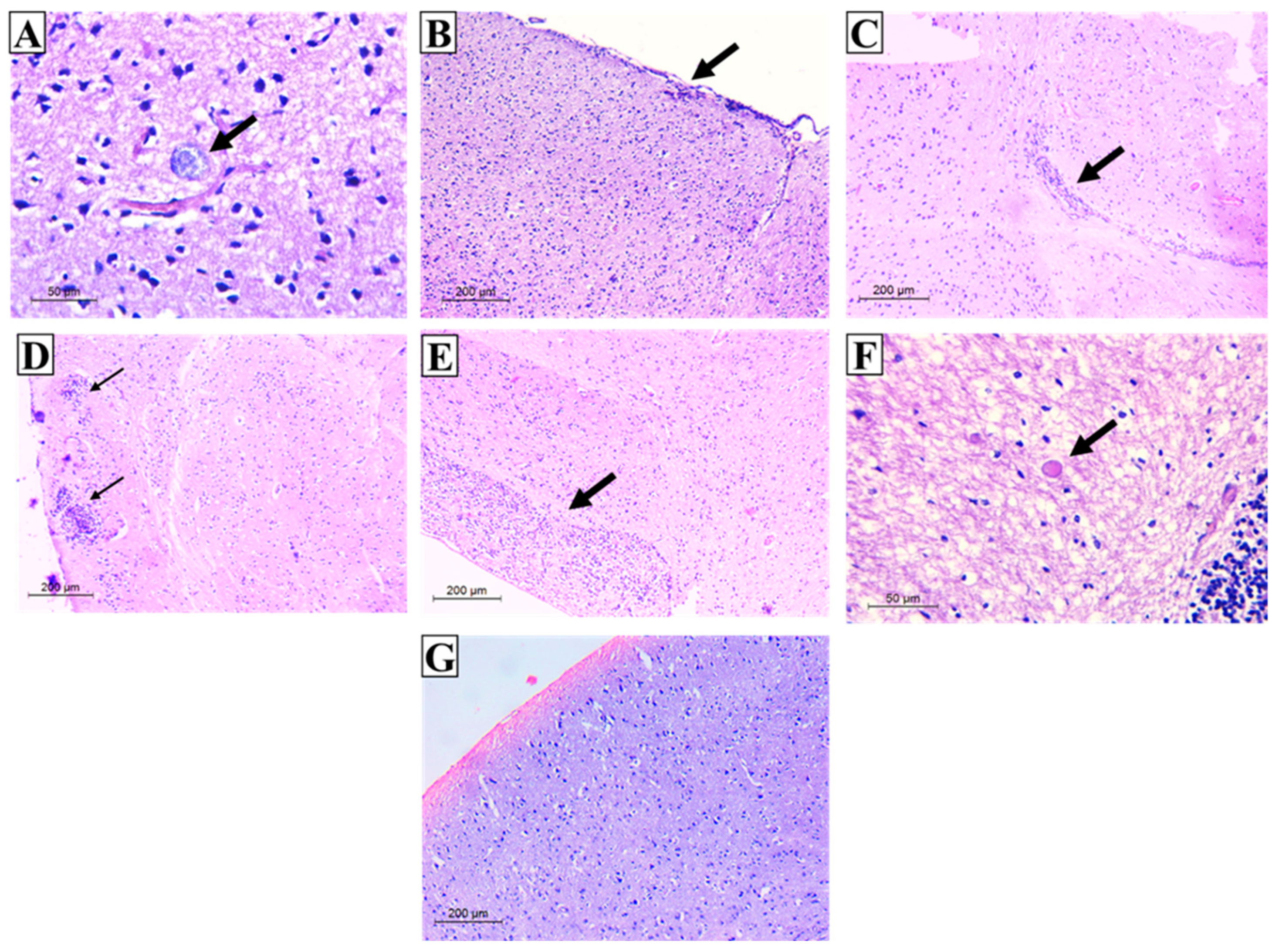 Tropicalmed 07 00401 g011