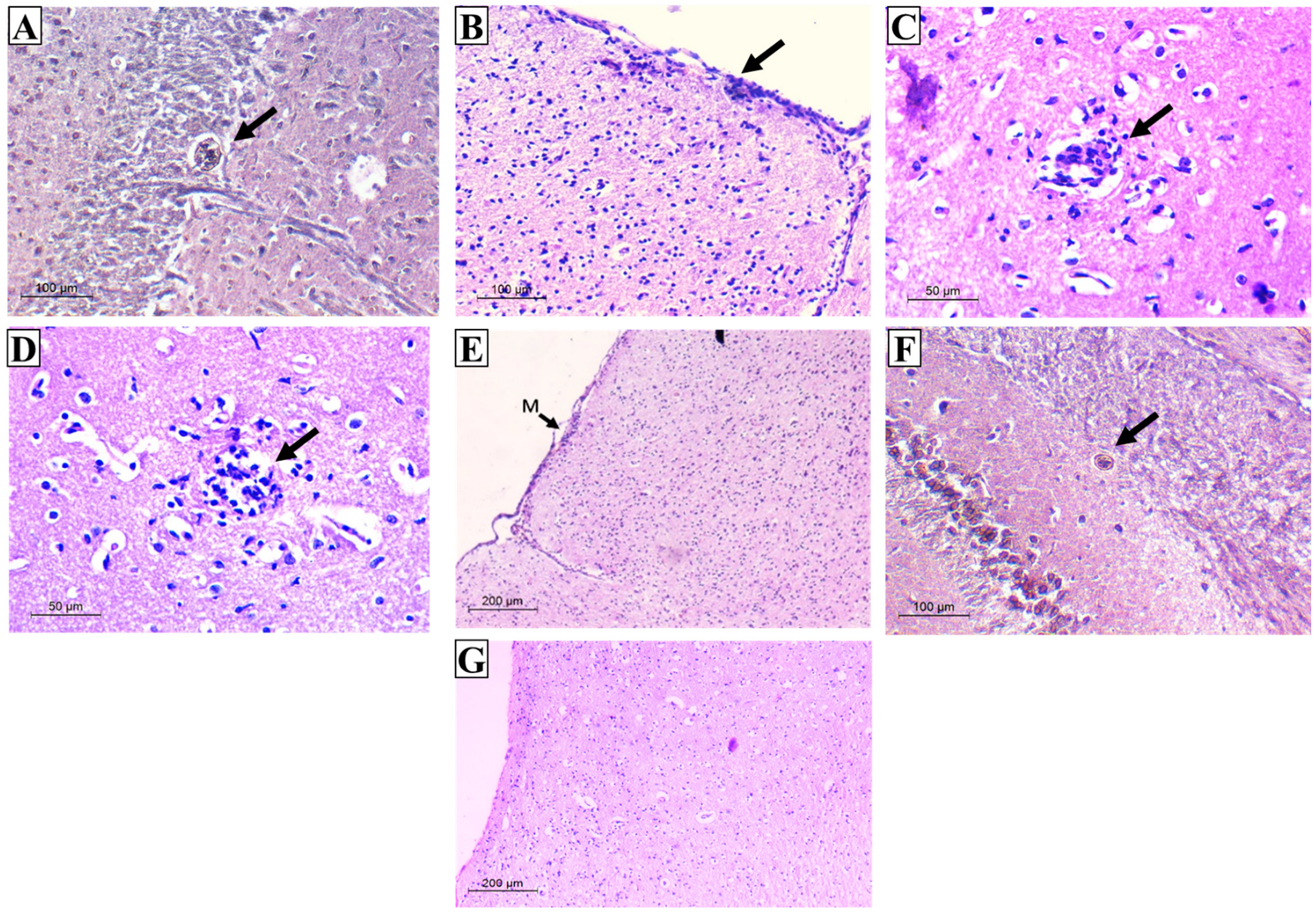 Tropicalmed 08 00106 g009