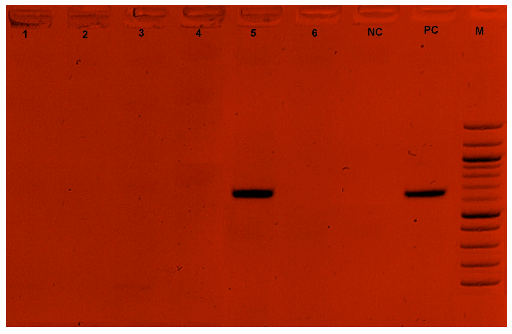 Tropicalmed 09 00192 g004