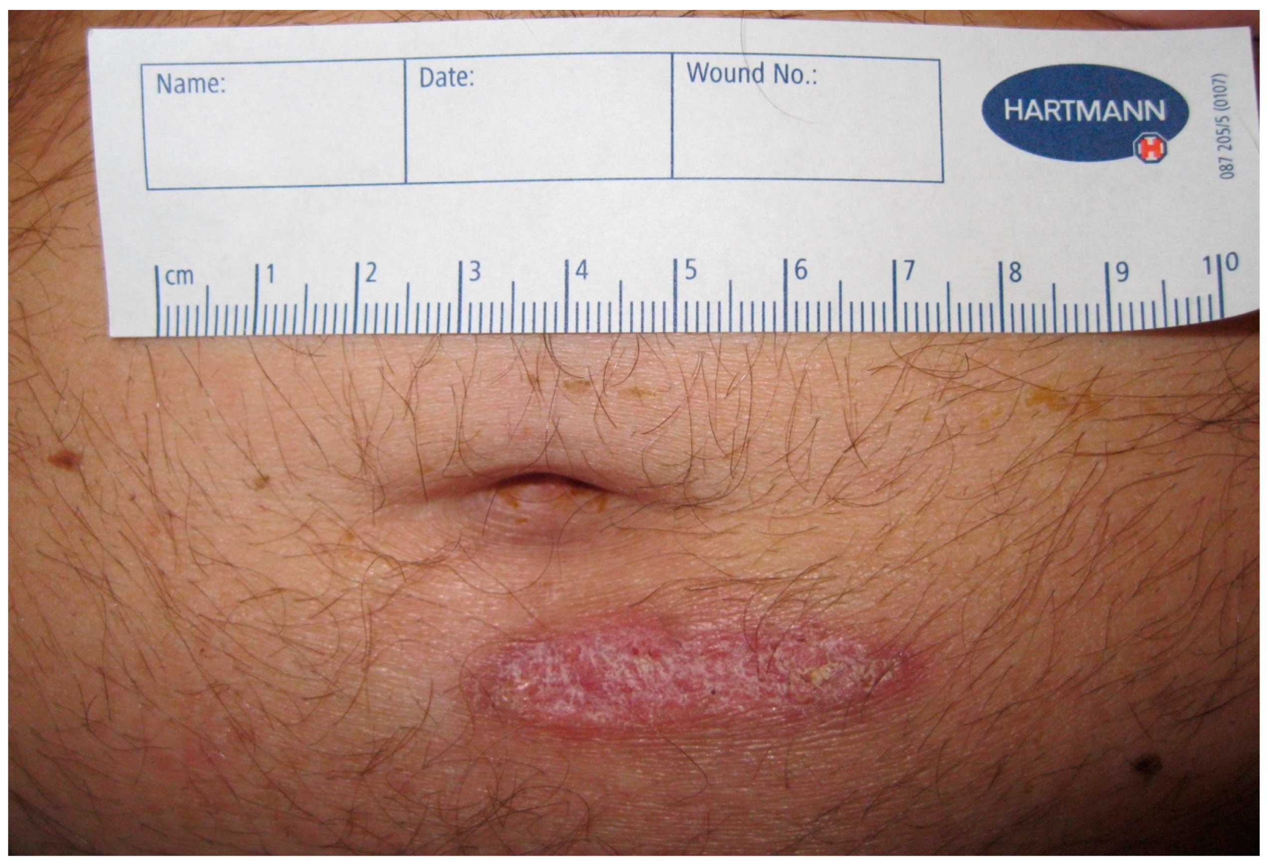 Tropicalmed 09 00242 g001 Tropicalmed 09 00242 g001