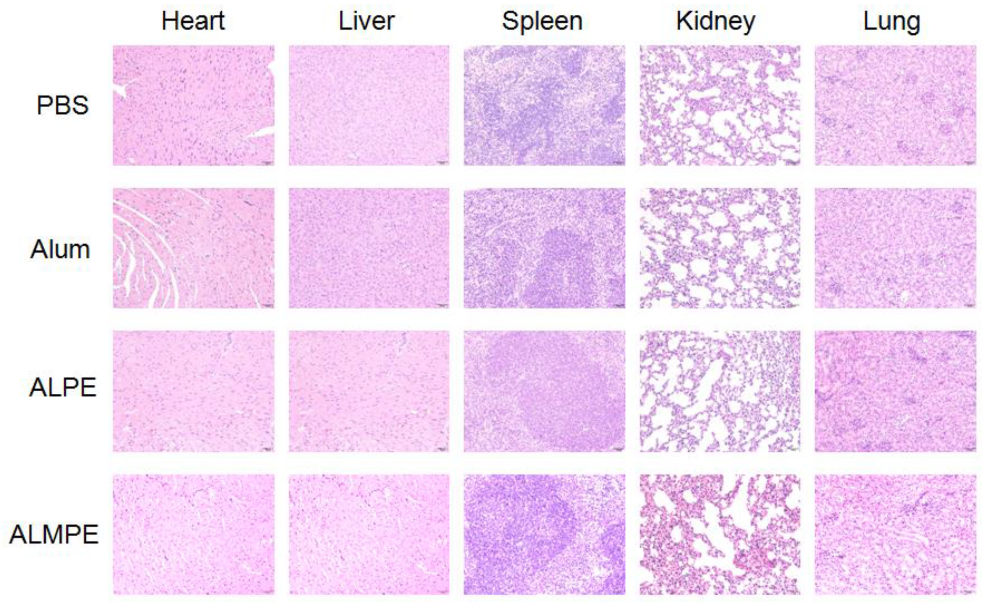 Vaccines 09 01244 g012