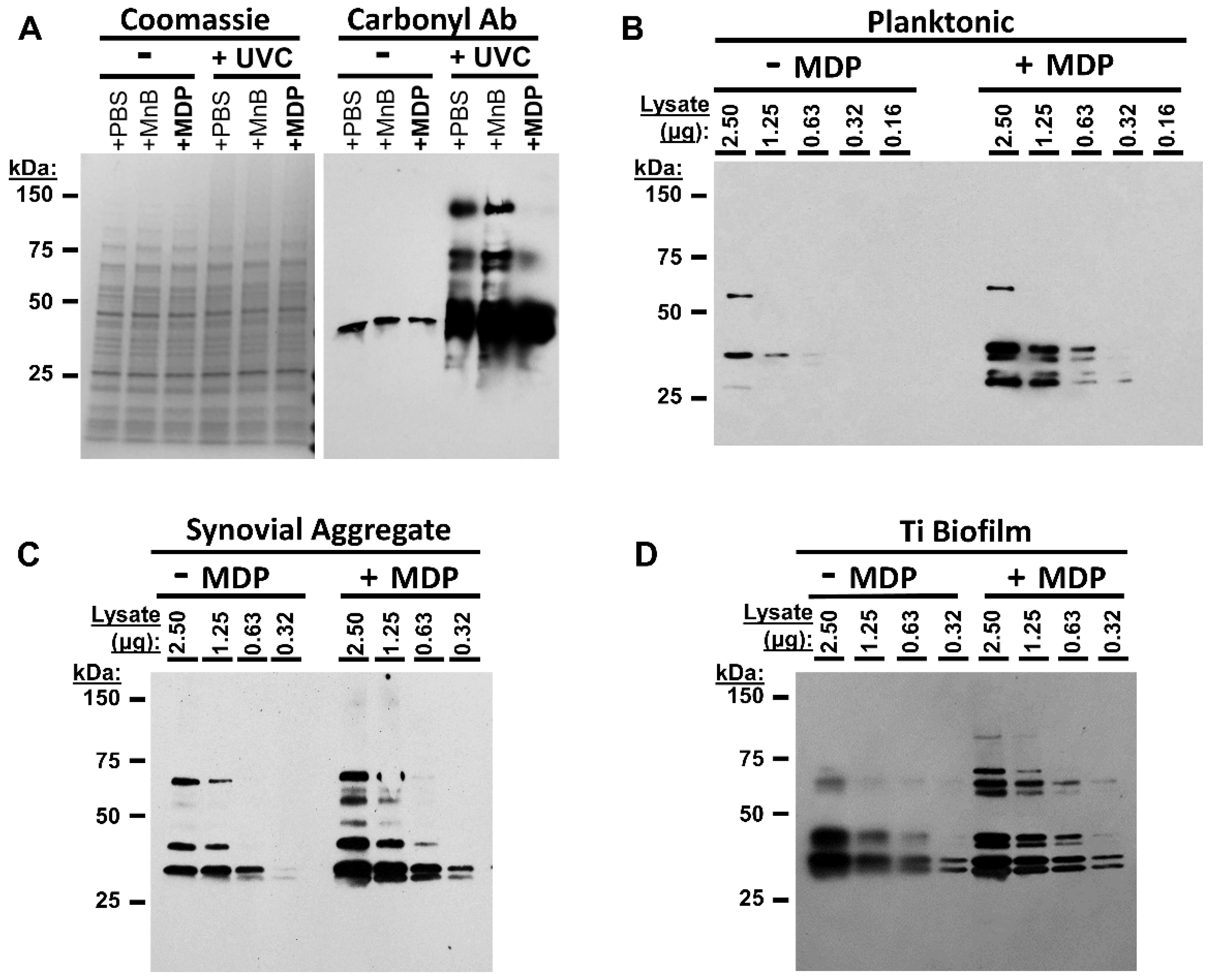 Vaccines 10 00833 g003 Vaccines 10 00833 g003