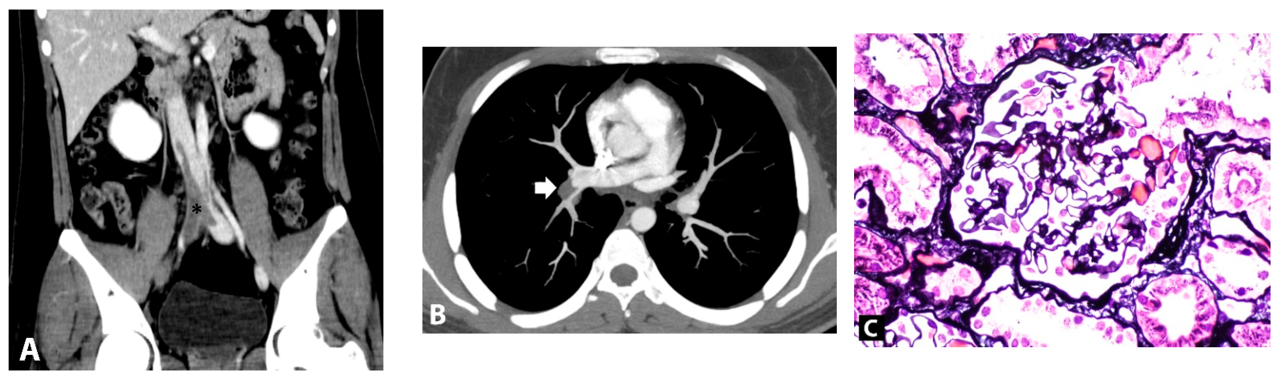 Vaccines 10 01888 g001 Vaccines 10 01888 g001