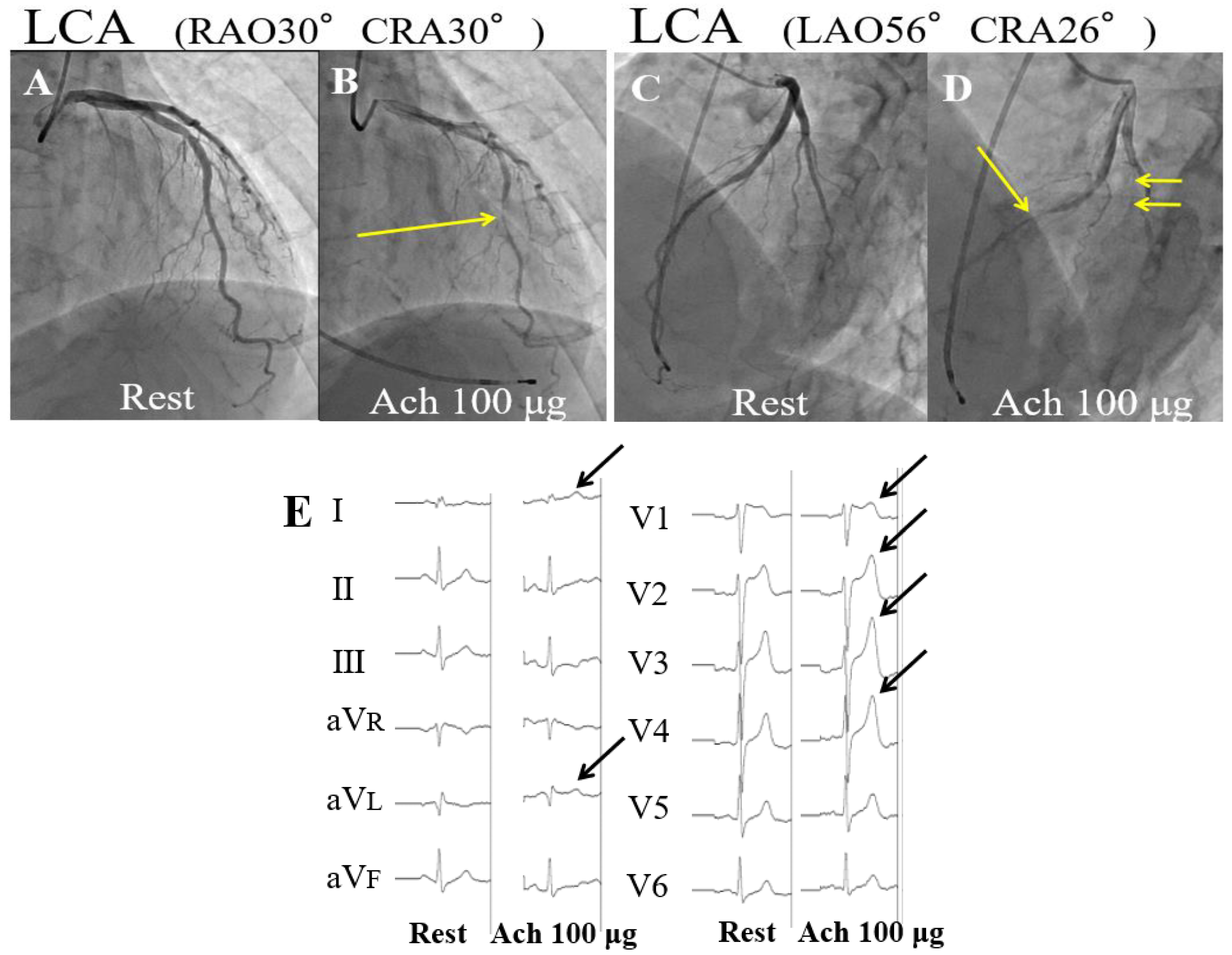 Vaccines 10 01998 g001 Vaccines 10 01998 g001