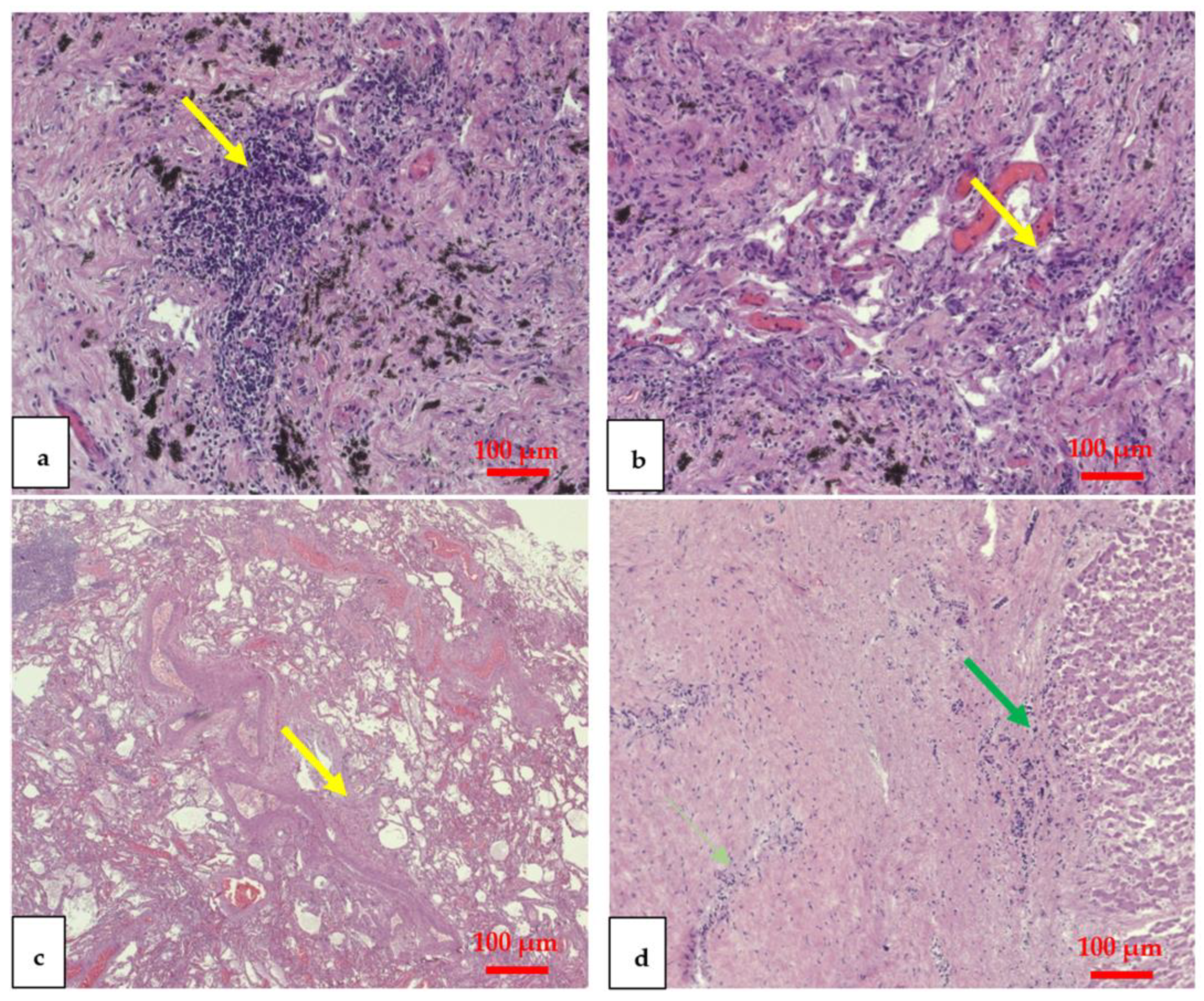 Vaccines 11 00142 g002
