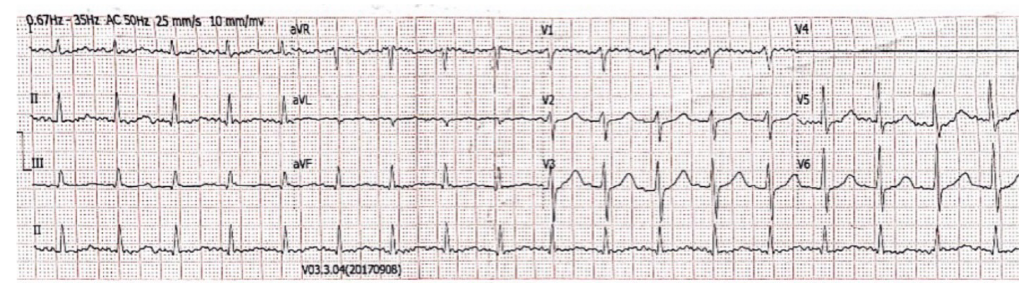 Vaccines 11 00220 g003 Vaccines 11 00220 g003