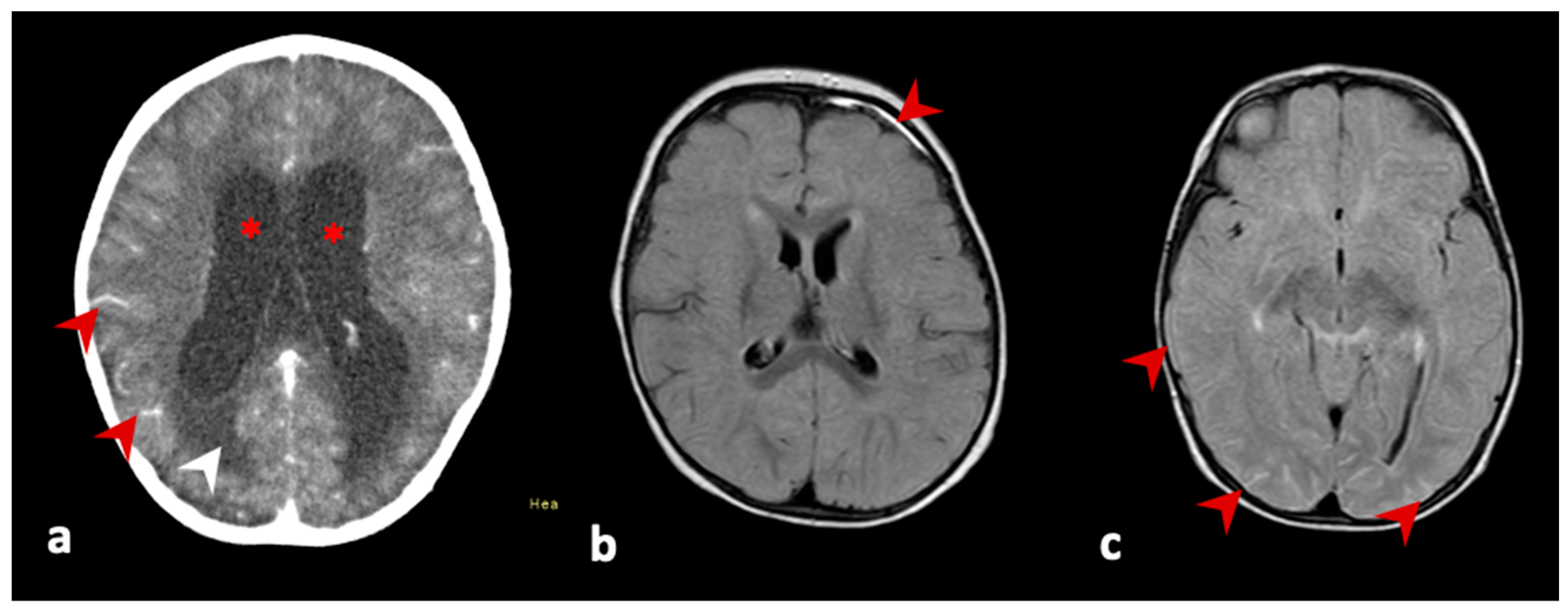 Vaccines 11 00445 g001 Vaccines 11 00445 g001