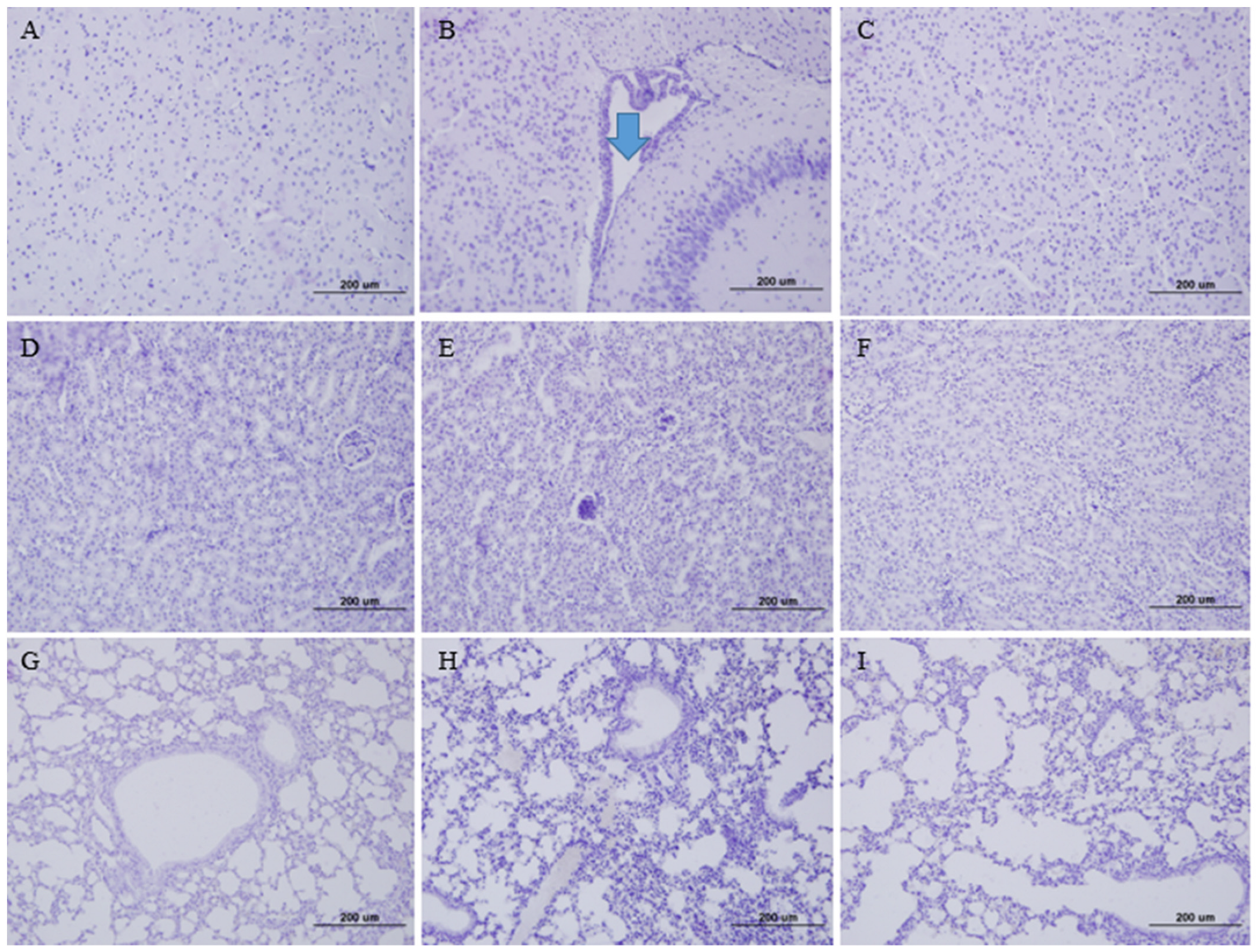Vaccines 11 01353 g005