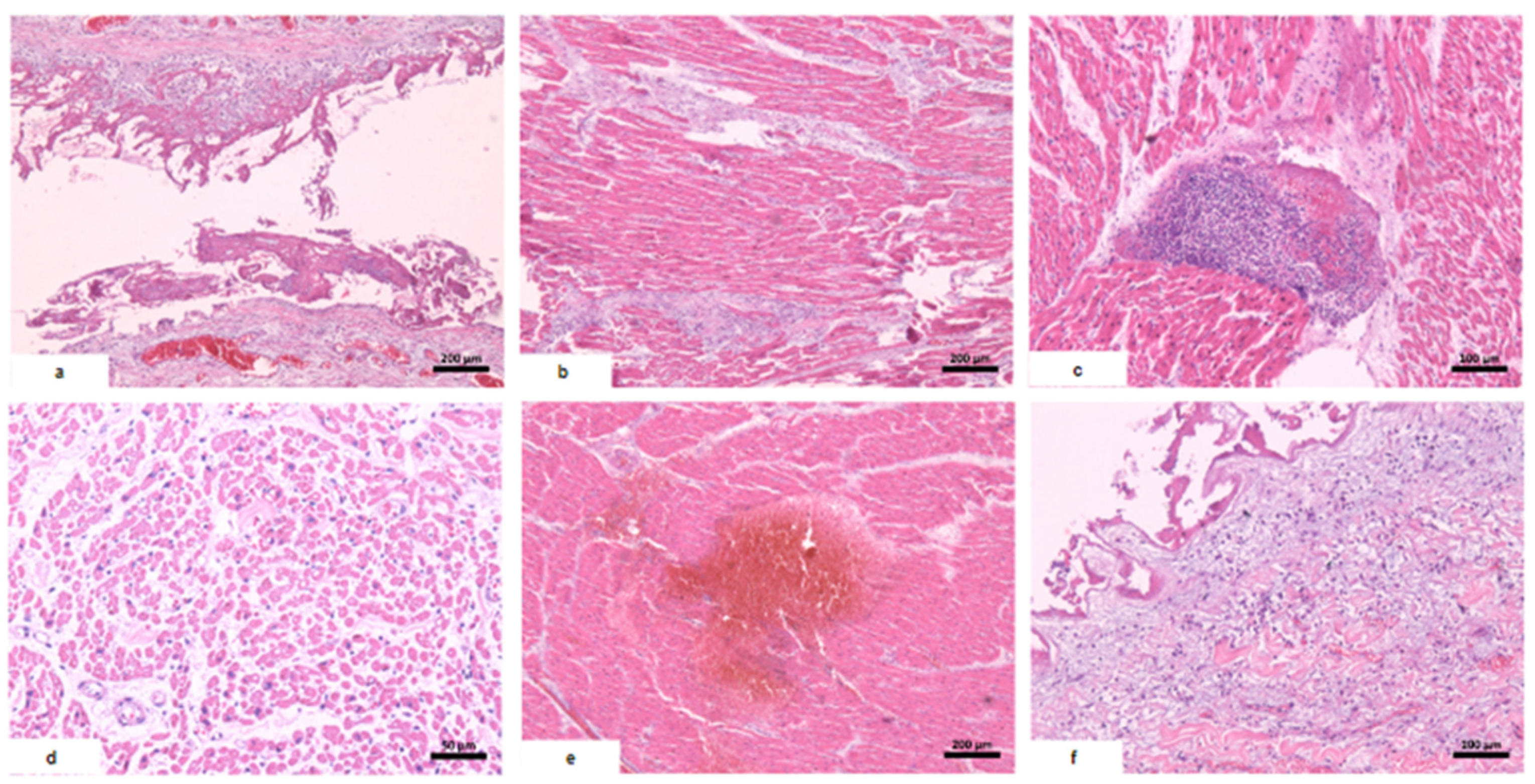 Vaccines 12 00194 g002