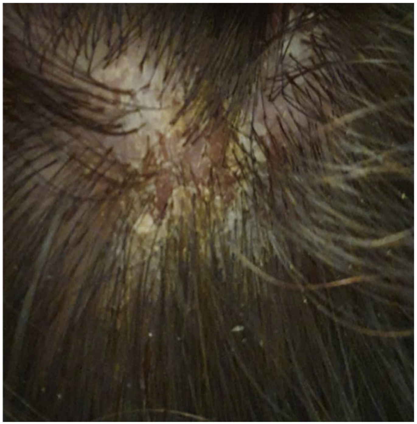 Vaccines 12 00857 g002