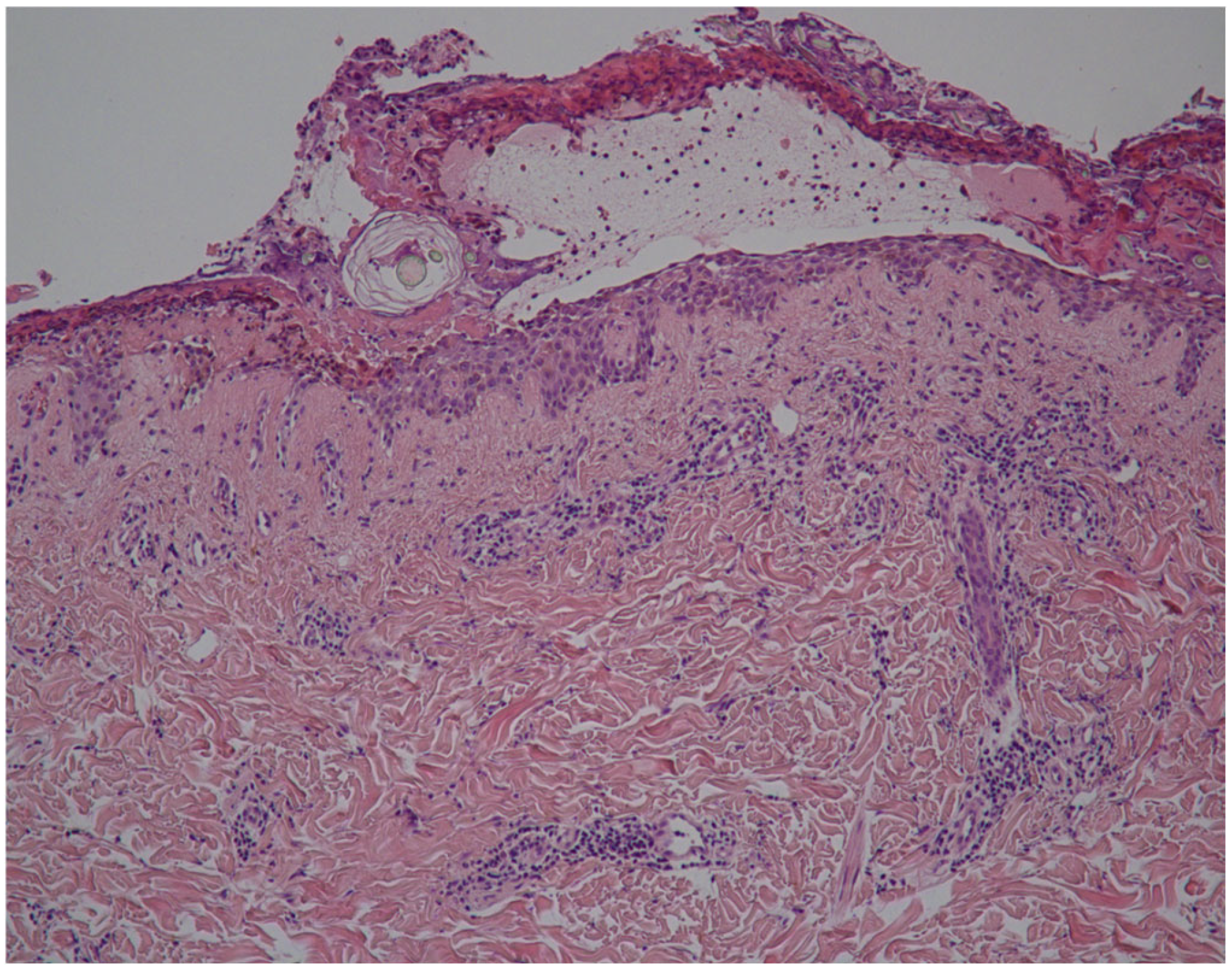 Vaccines 12 00857 g004