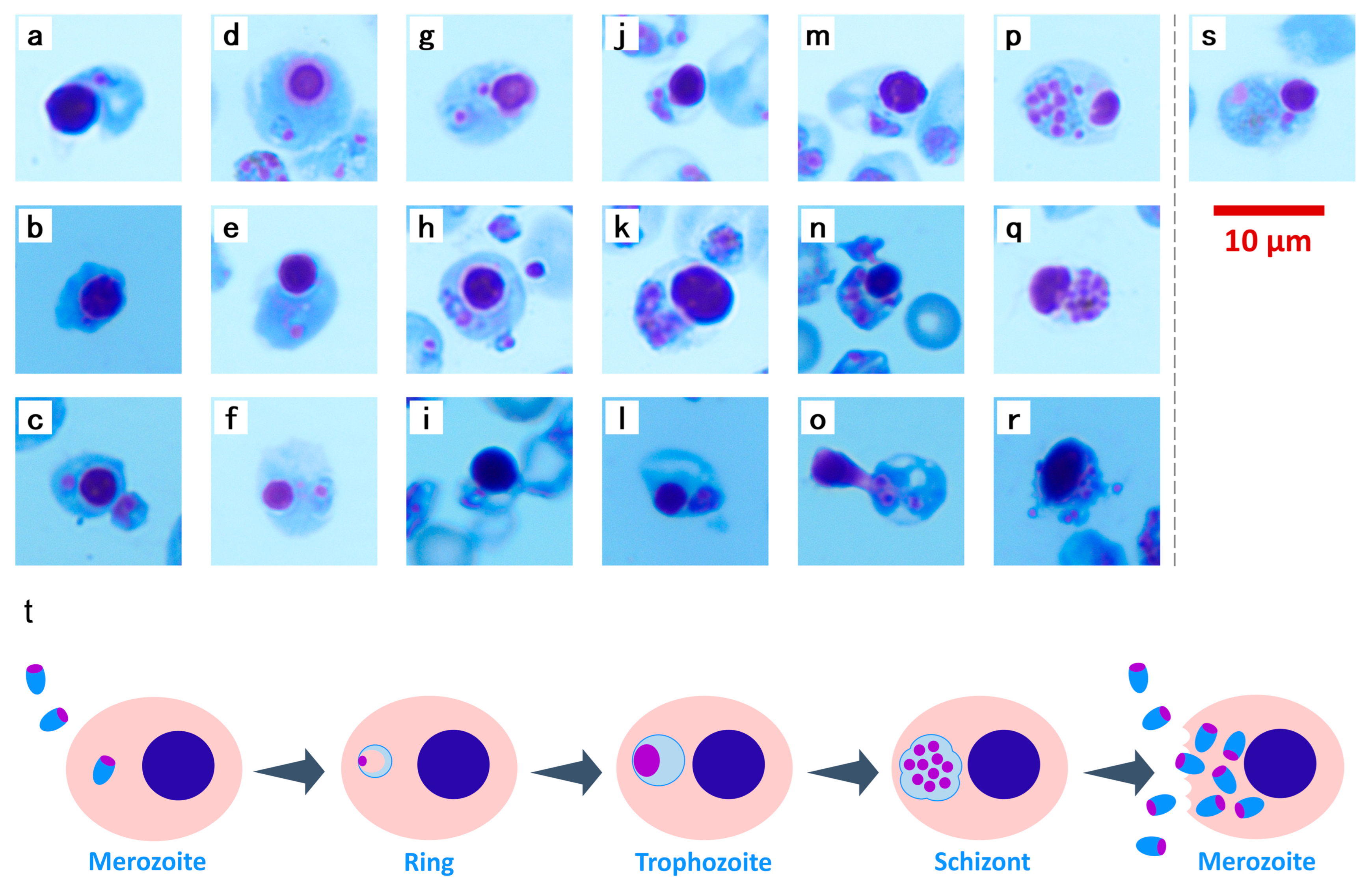 Vaccines 13 00988 g005 Vaccines 13 00988 g005