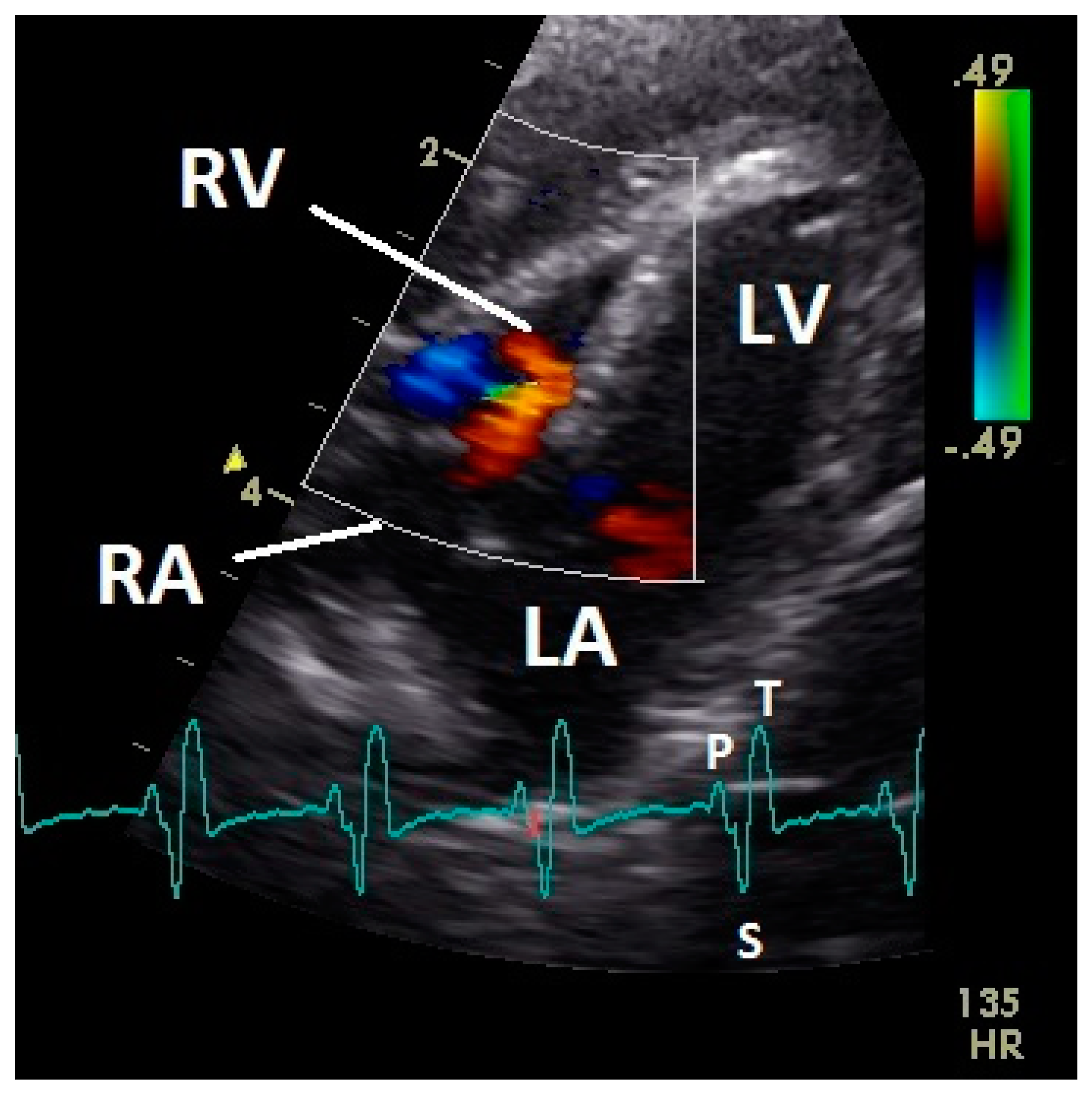 Veterinary Sciences | Free Full-Text | Color Flow Doppler Echocardiography  in Healthy Racing Pigeons (Columba livia f. domestica) and the Evidence of  Physiological Blood Flow Vortex Formations