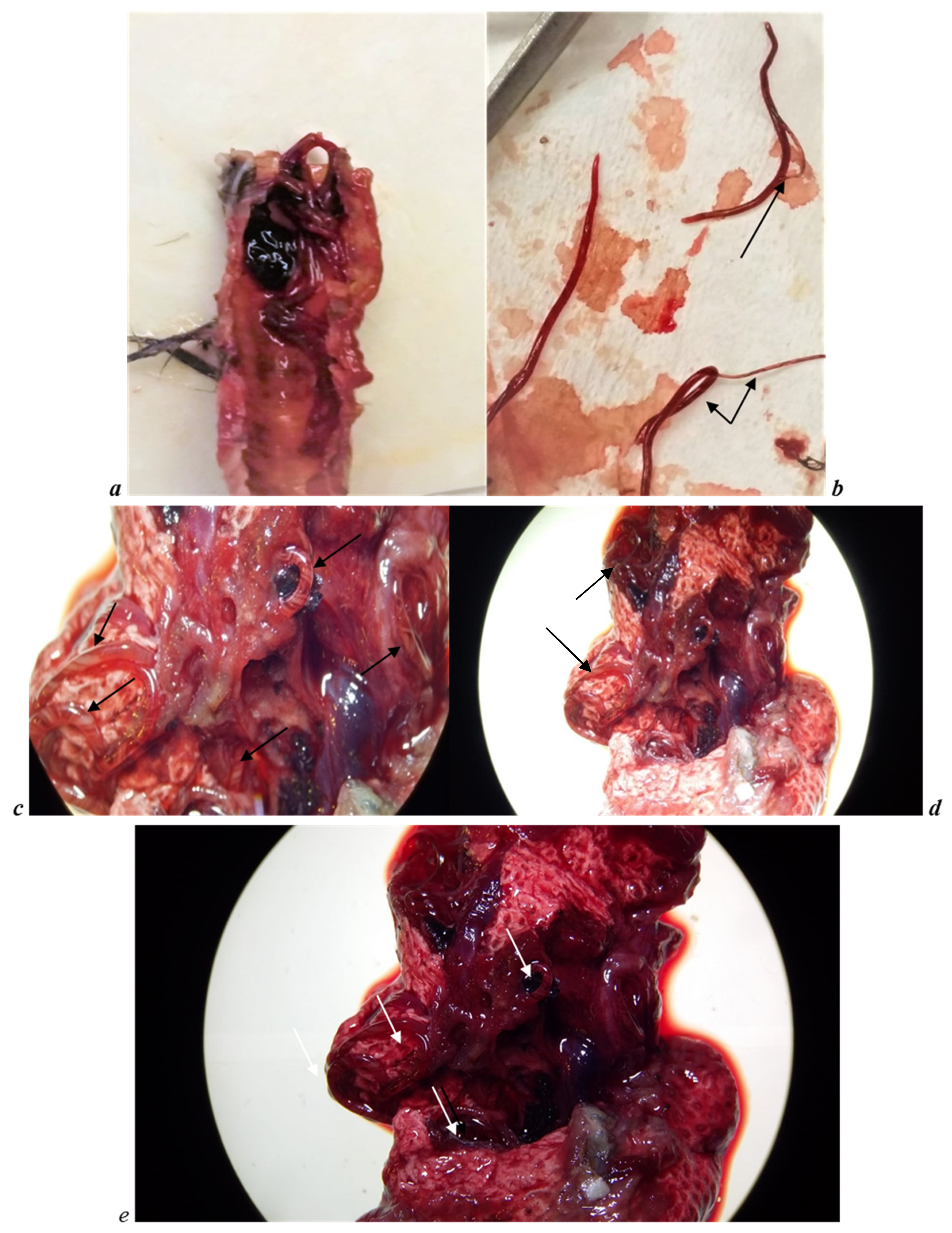 Large blood clots after abortion pill