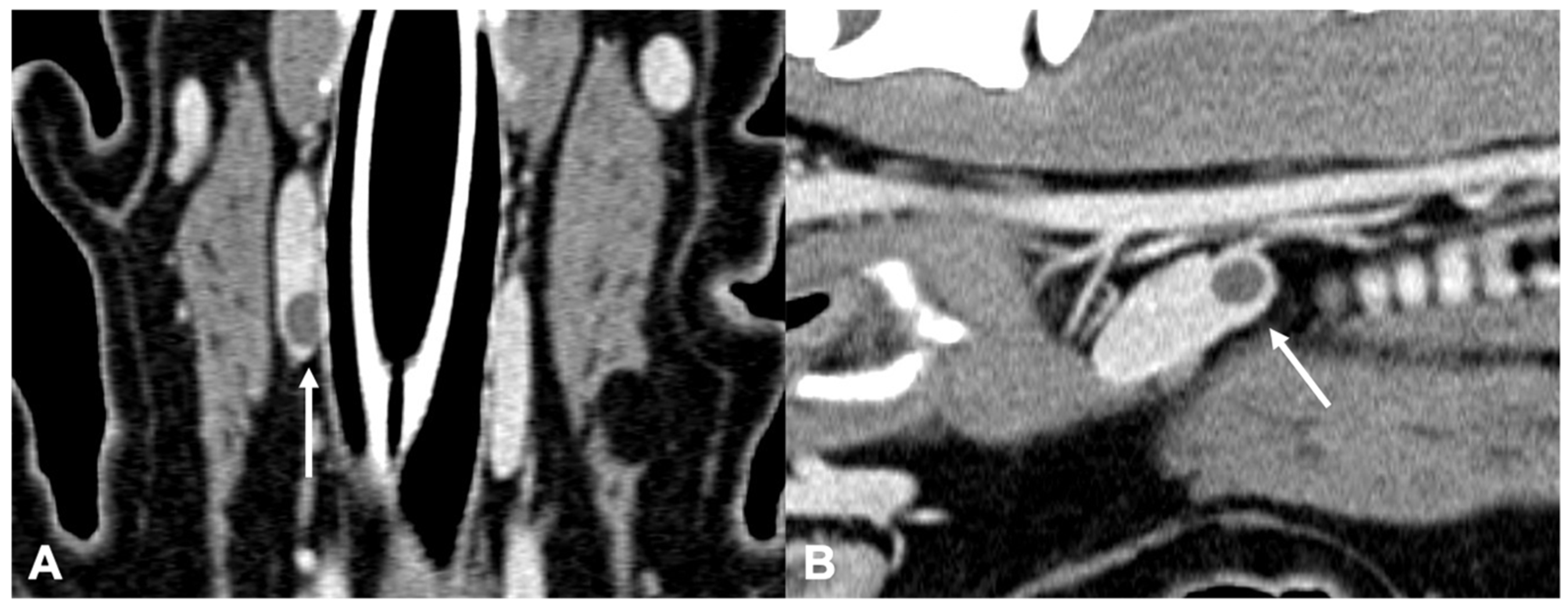 Veterinary Sciences | Free Full-Text | Multidetector-Row CT Findings in ...