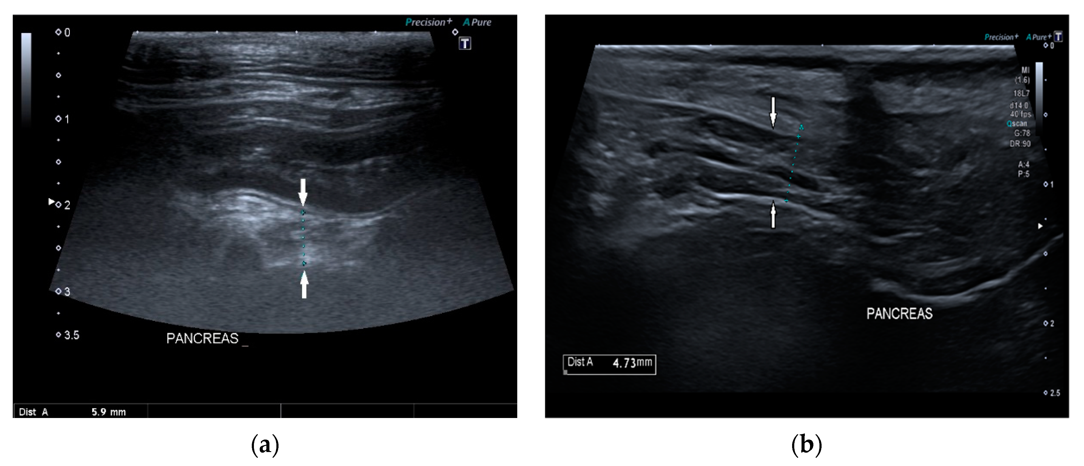 how is exocrine pancreatic insufficiency treated in dogs