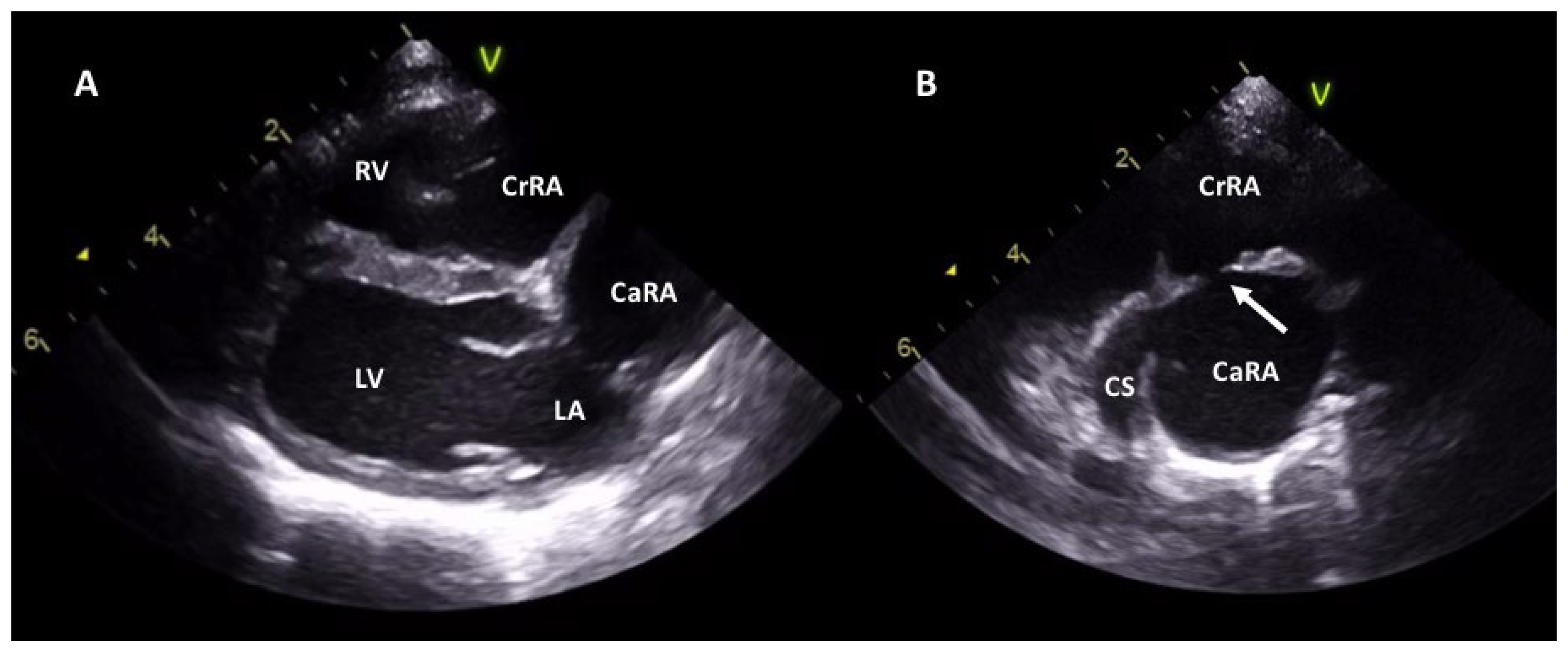 How Long Does A Dog Echocardiogram Take