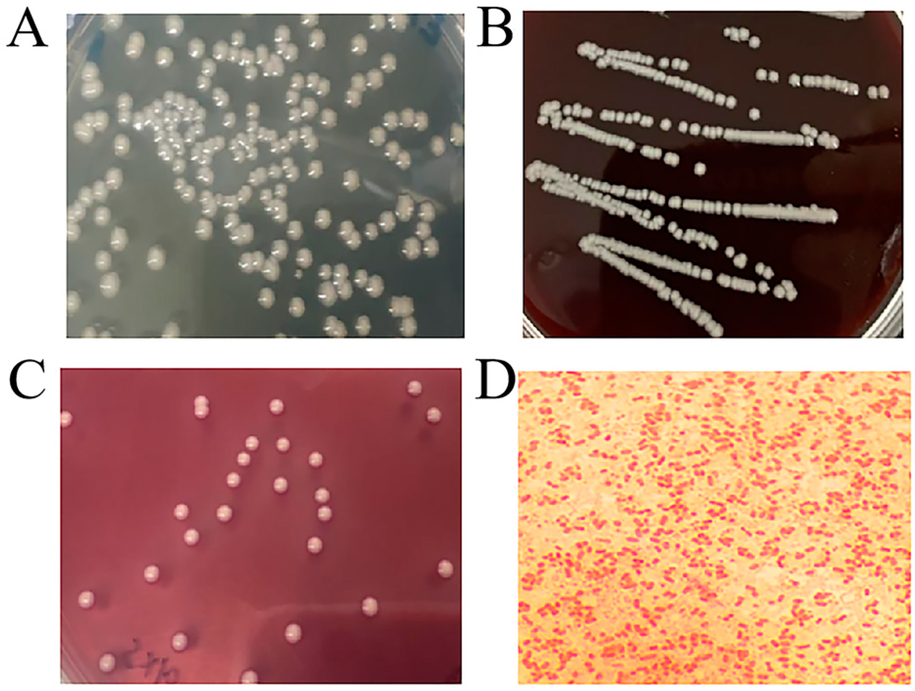 klebsiella pneumoniae gram stain morphology