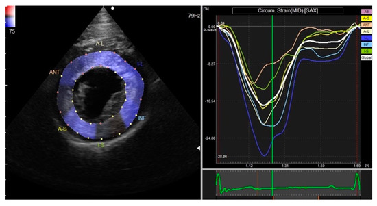 Reference centiles for left ventricular longitudinal global and regional  systolic strain by automated functional imaging in healthy Egyptian  children, Cardiology in the Young