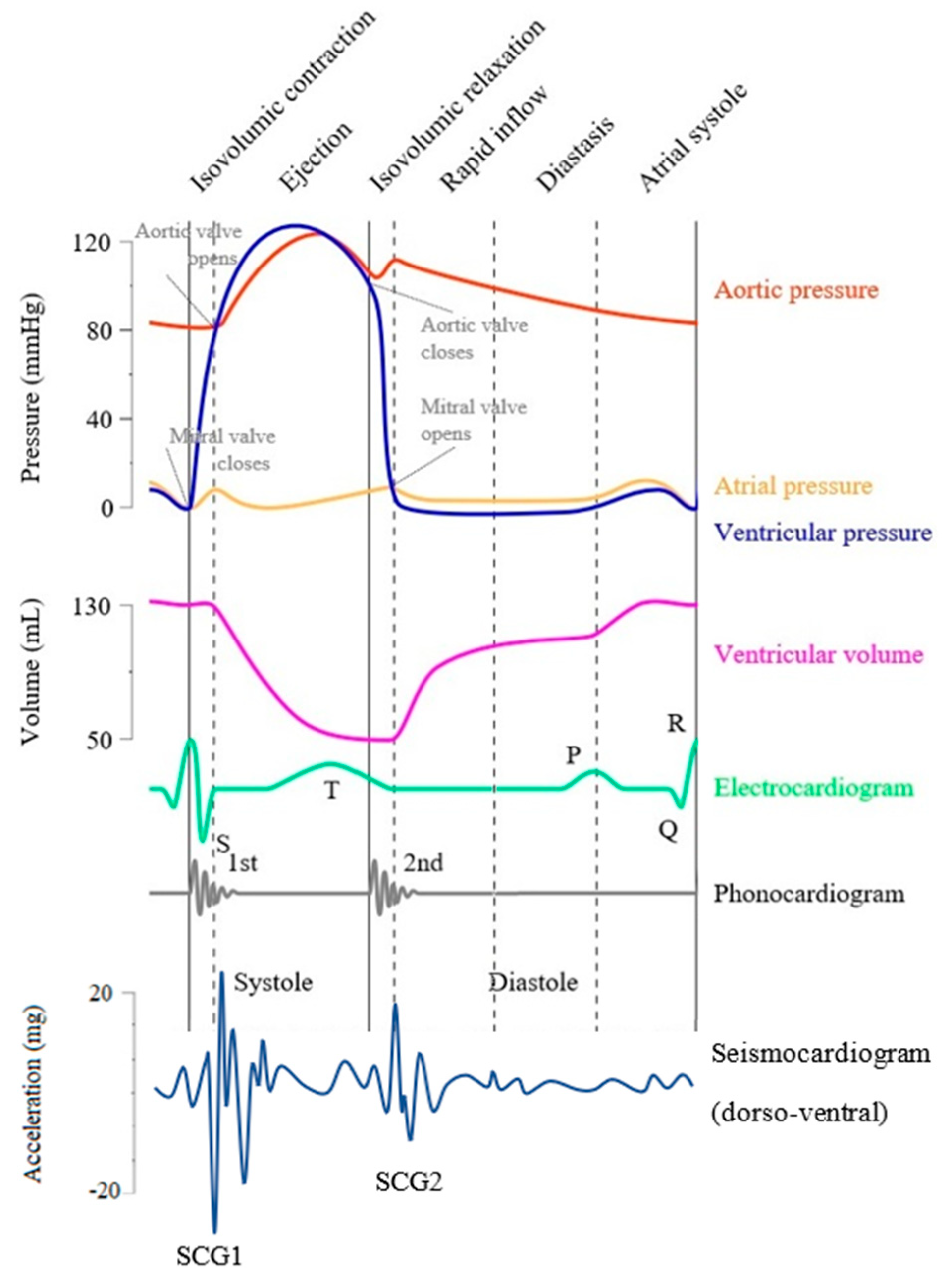 Vibration | Free Full-Text | Recent Advances in Seismocardiography | HTML