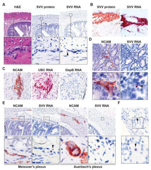 Viruses | Free Full-Text | Simian Varicella Virus Infects Enteric