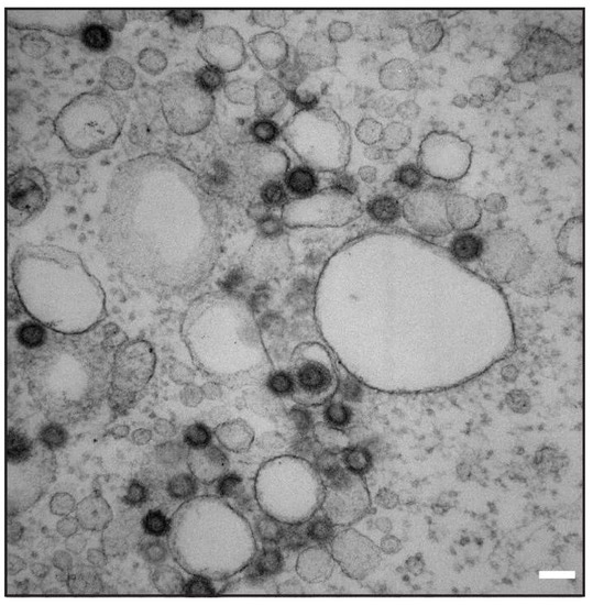 Viruses | Free Full-Text | Mason-Pfizer Monkey Virus Envelope Glycoprotein  Cycling and Its Vesicular Co-Transport with Immature Particles | HTML