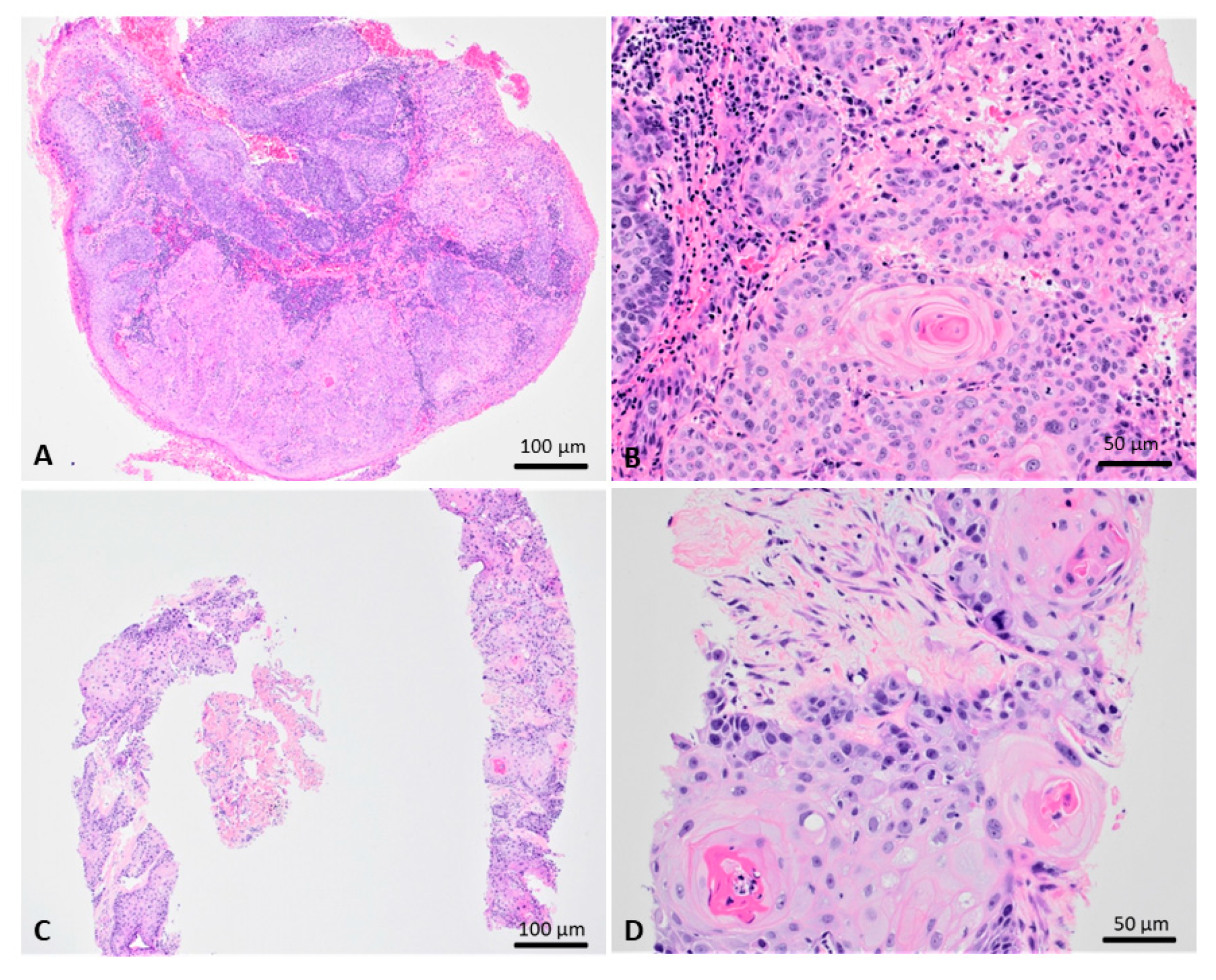 Viruses | Free Full-Text | Human Papillomavirus (HPV69/HPV73 ...