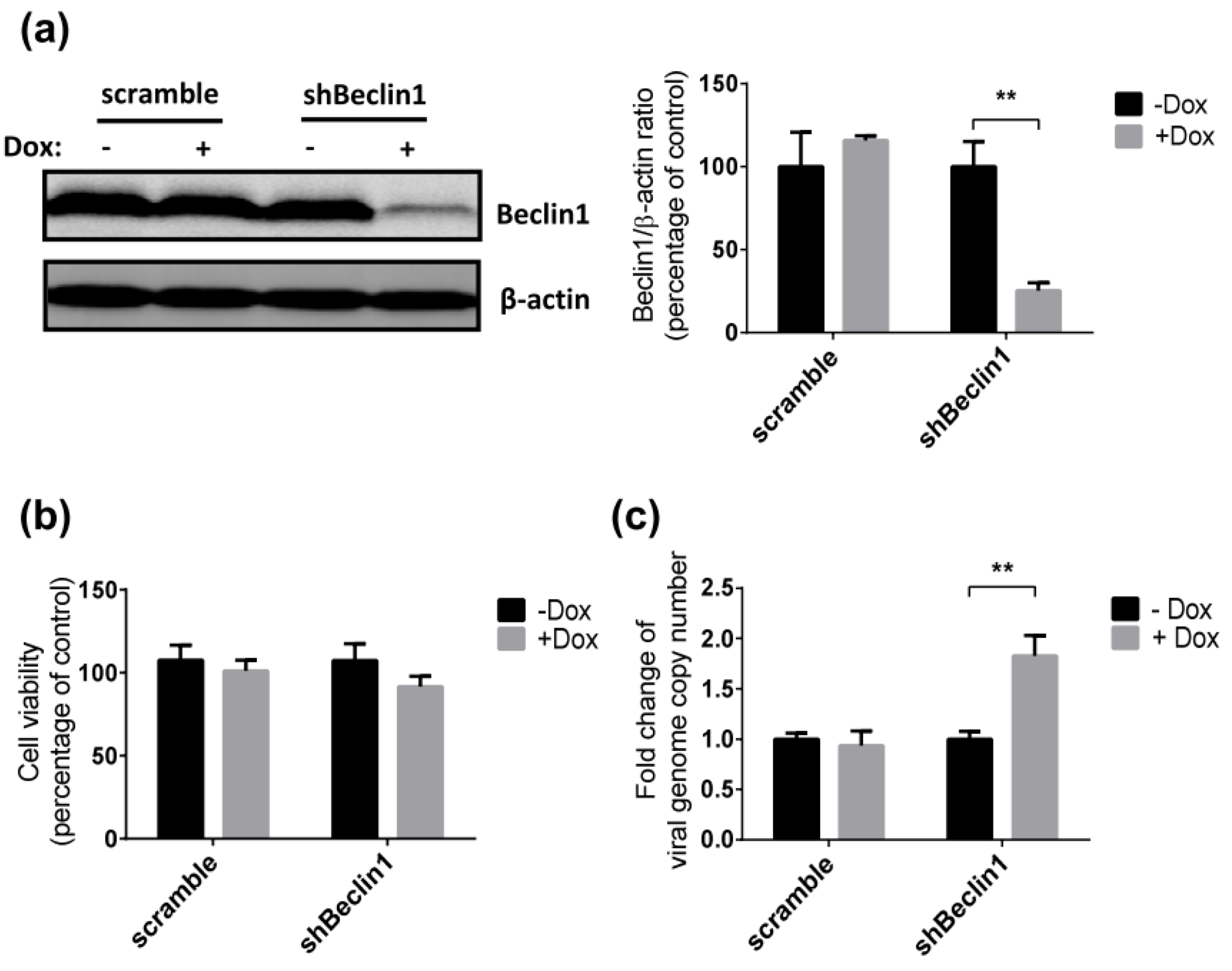 Viruses | Free Full-Text | Autophagy Induced by Simian Retrovirus