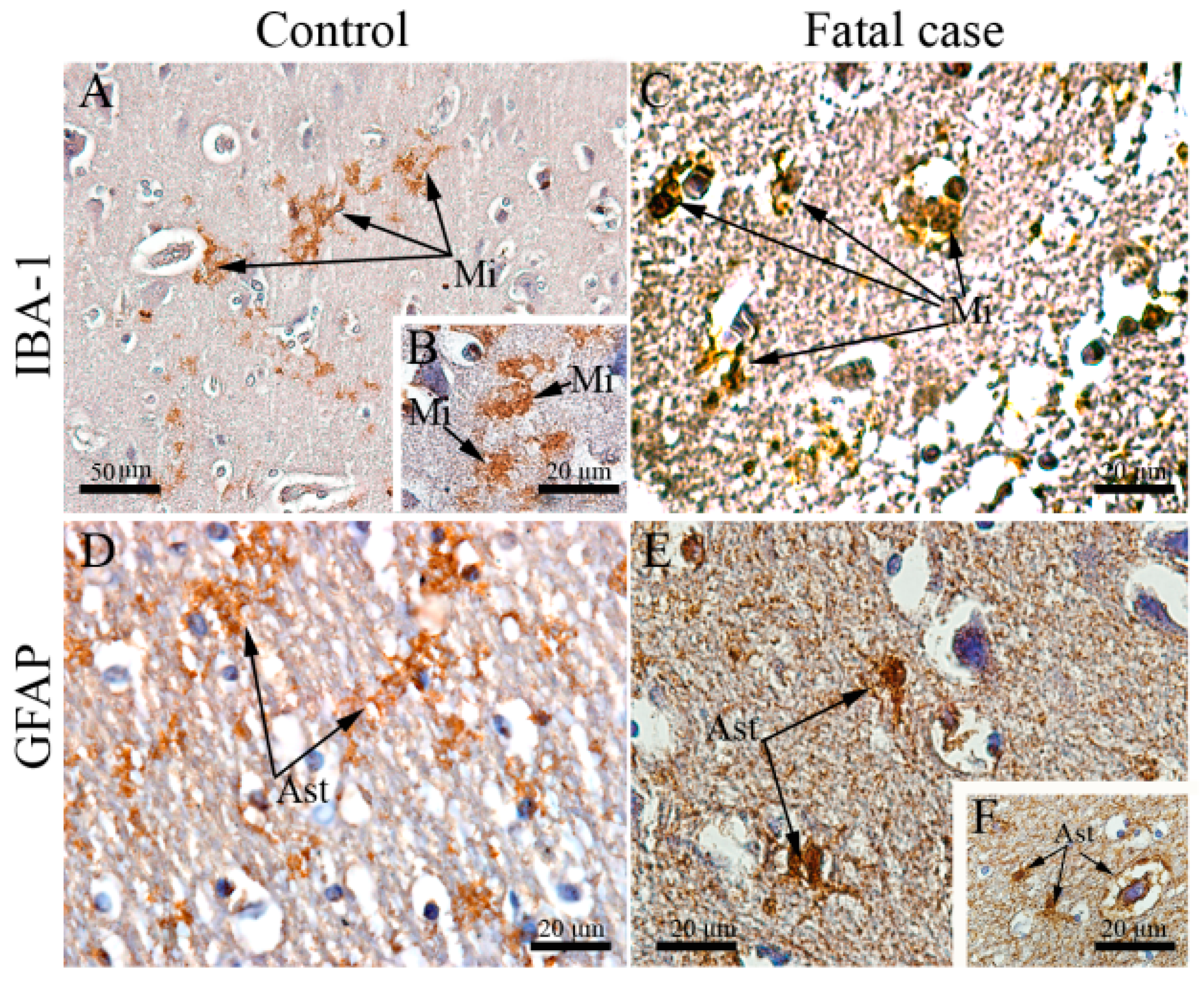 Viruses 12 00603 g002