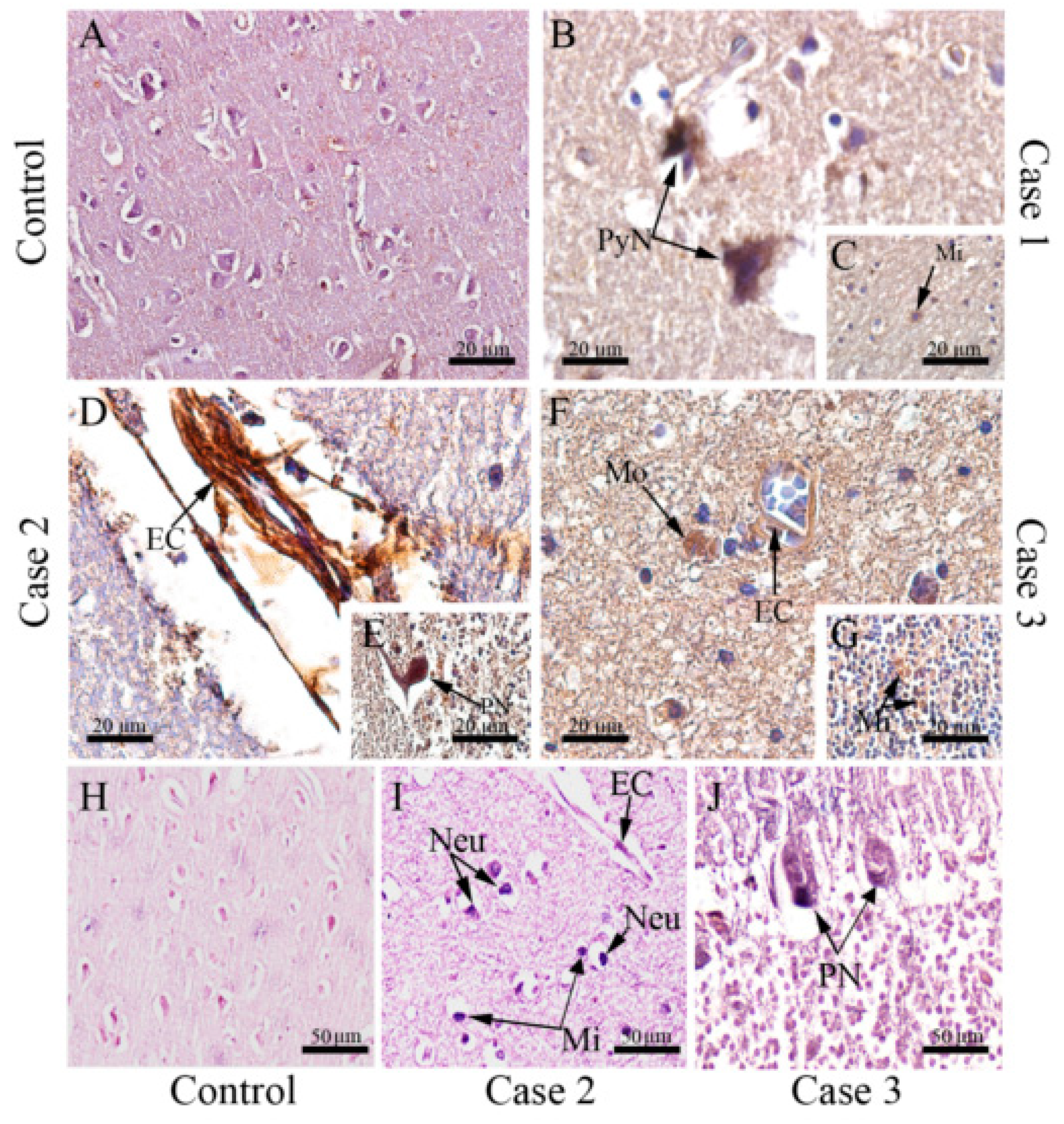 Viruses 12 00603 g004